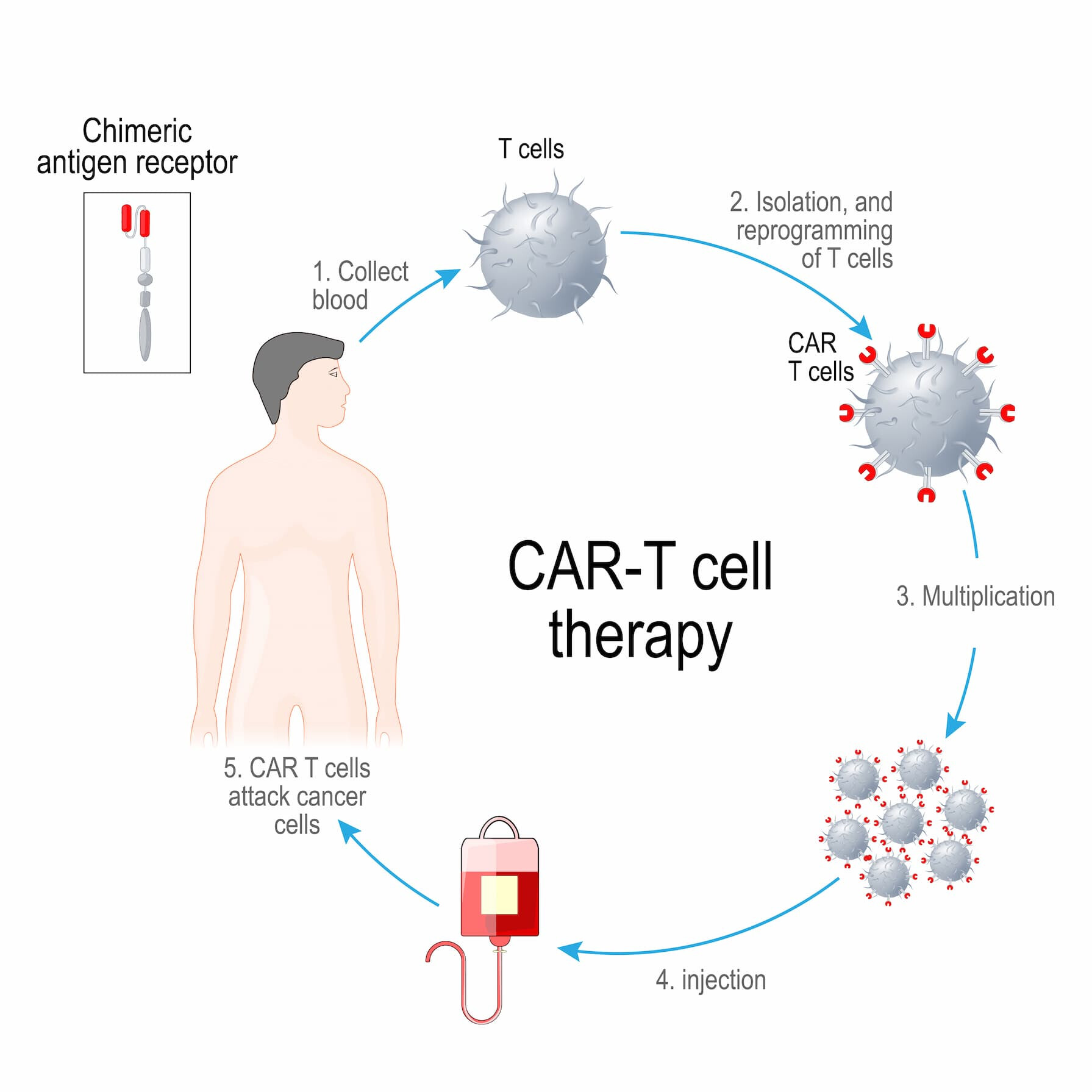 CAR-T Cell Treatment in Turkey | Check 2026 Cost & Prices