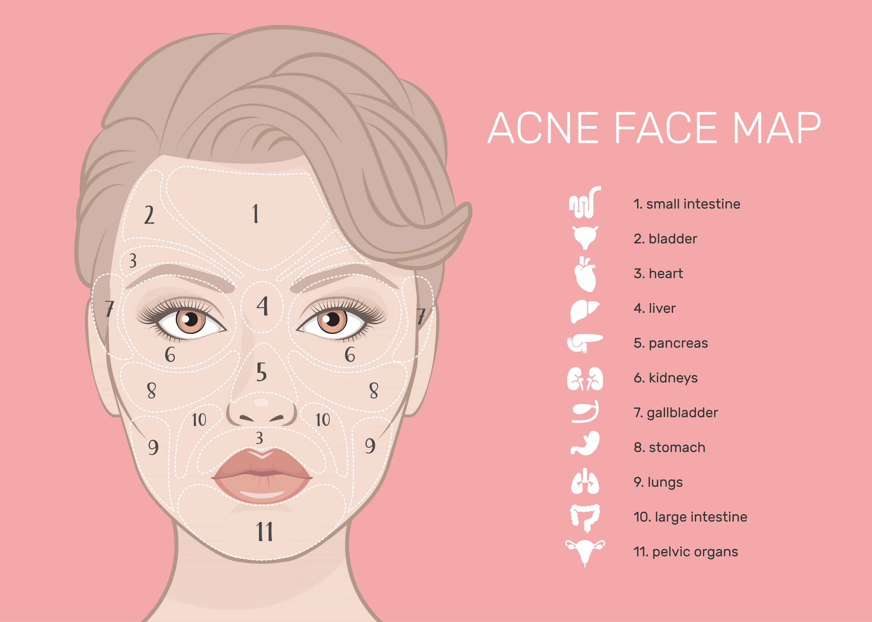 acne-face-map