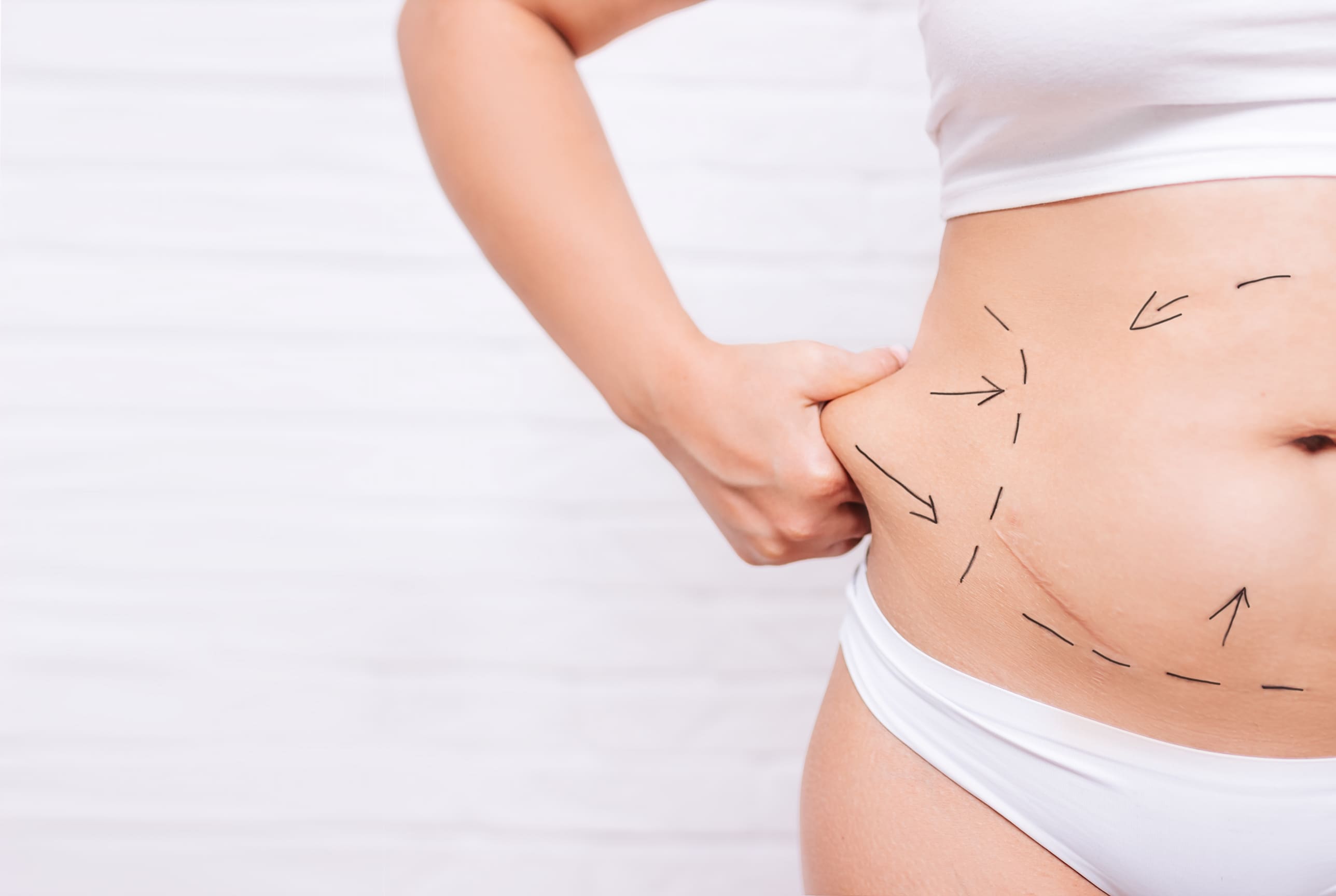 BMI for Liposuction