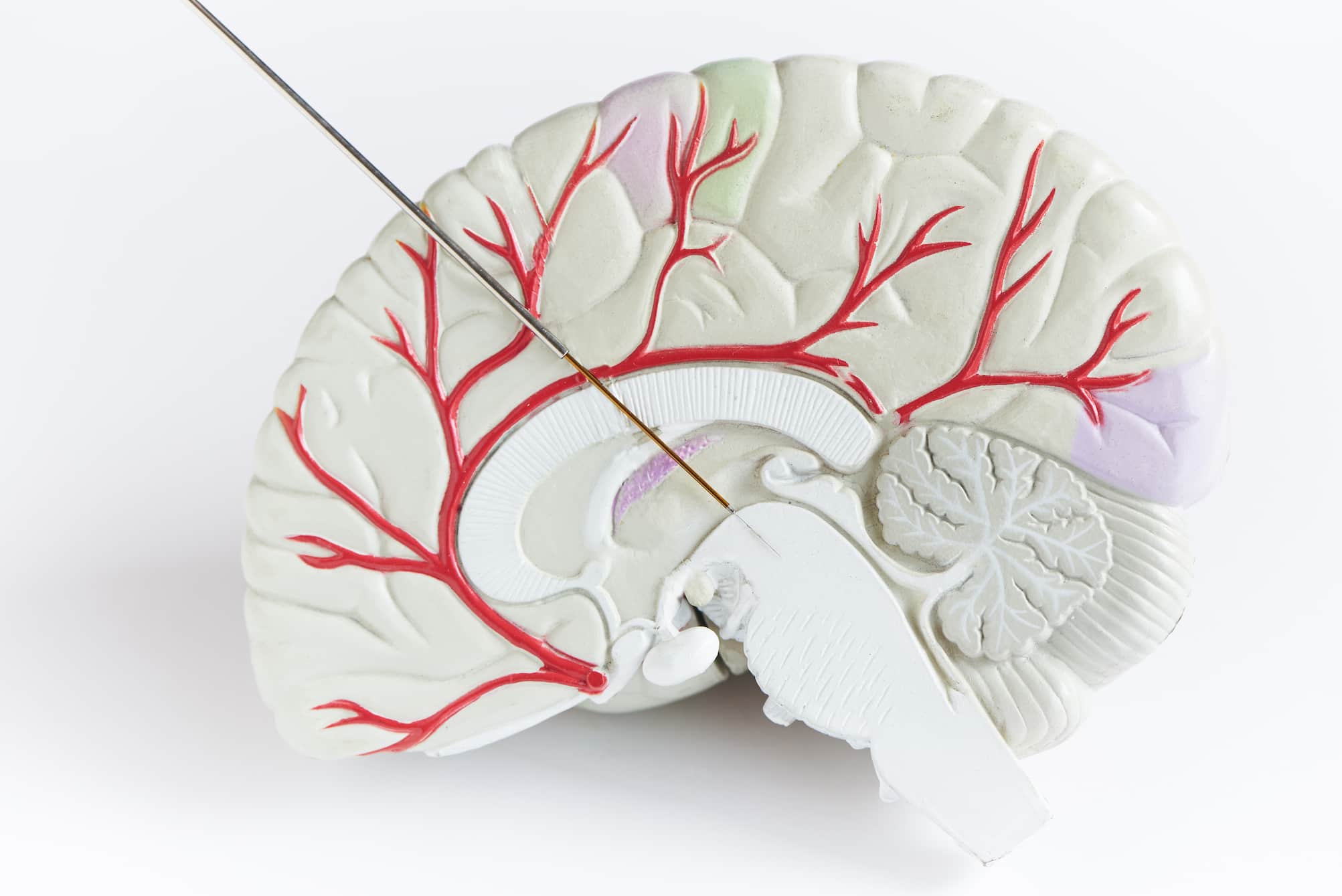 Deep Brain Stimulation as a Treatment Option