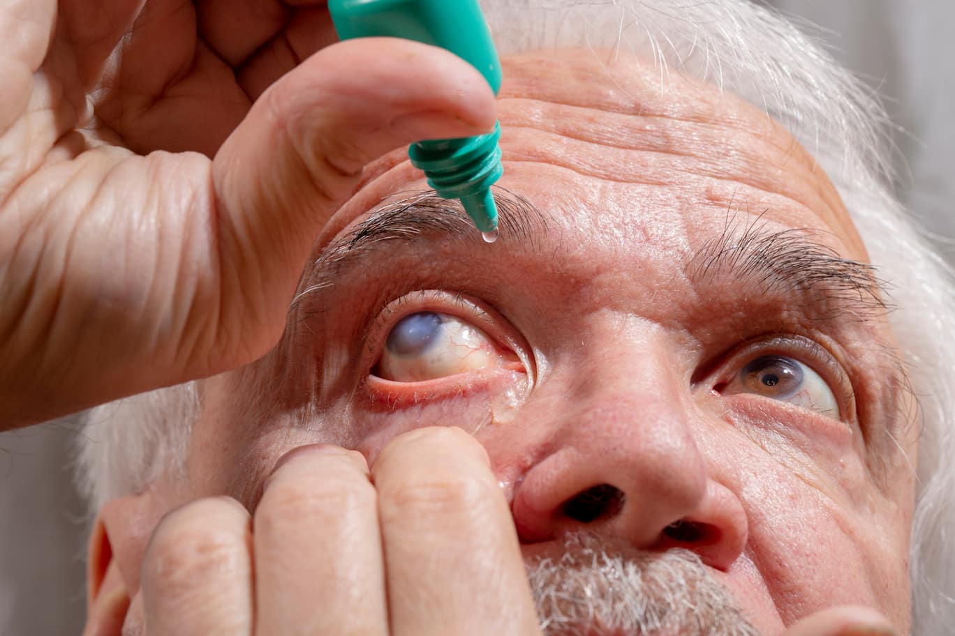 facts-about-glaucoma-treatment