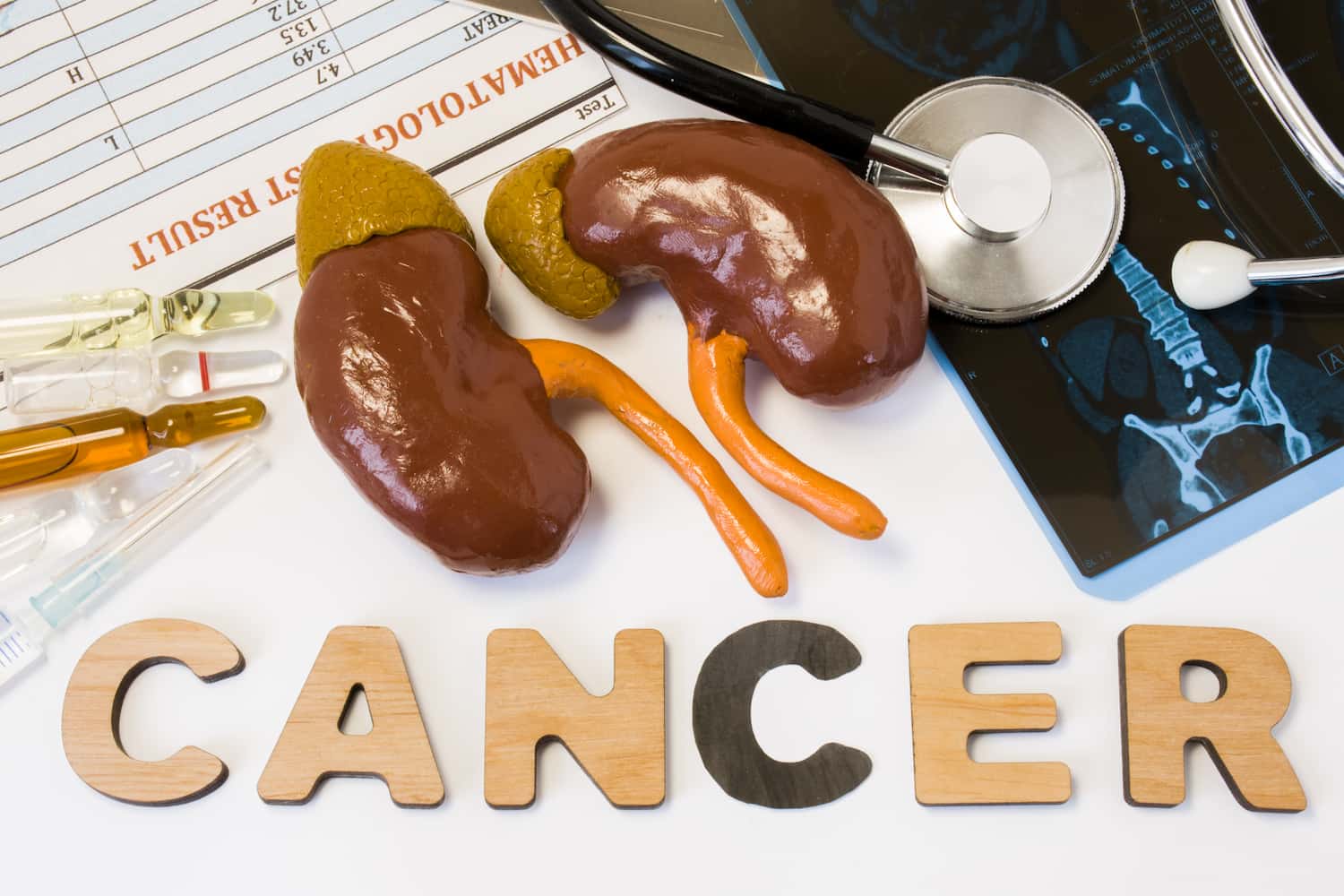 kidney-cancer-spread