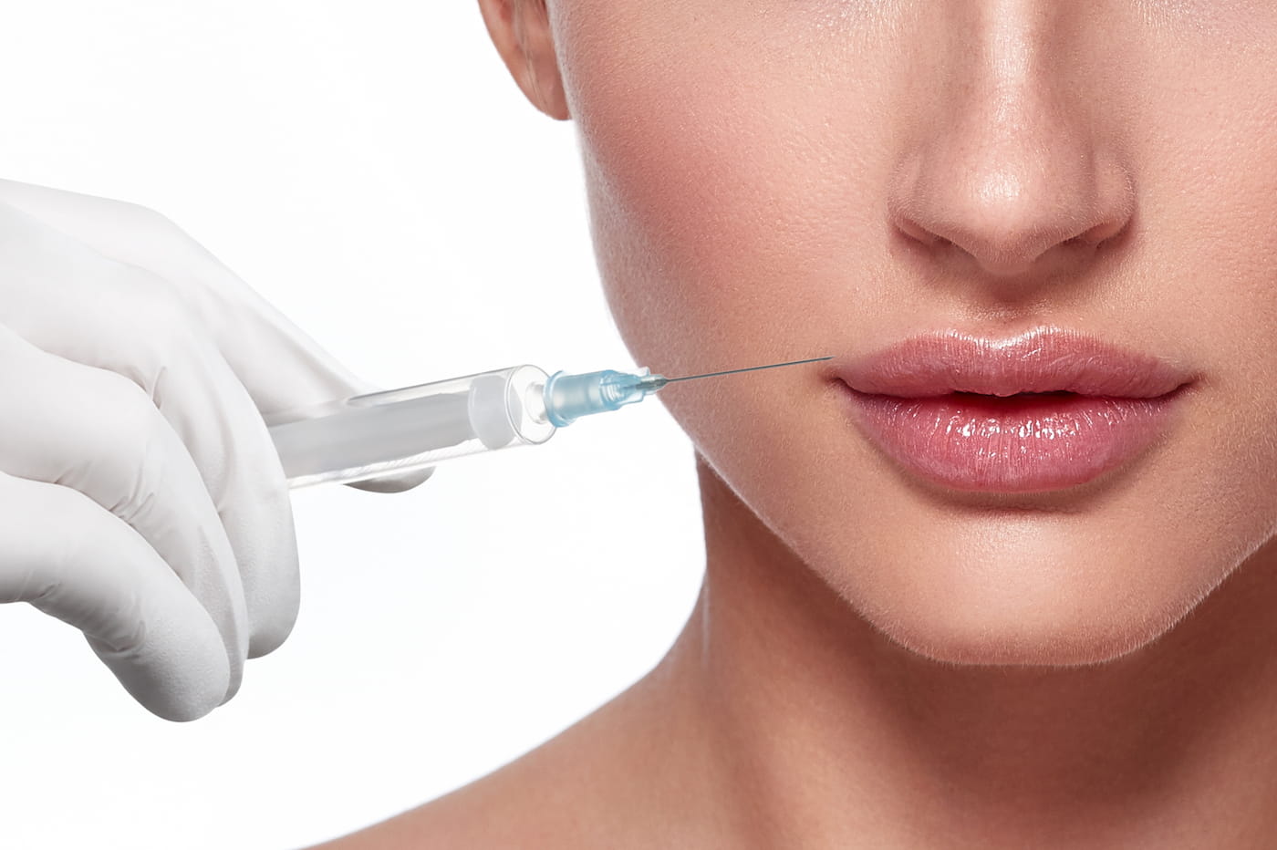 Lip Filler Migration: Why It Happens and Ways To Prevent It