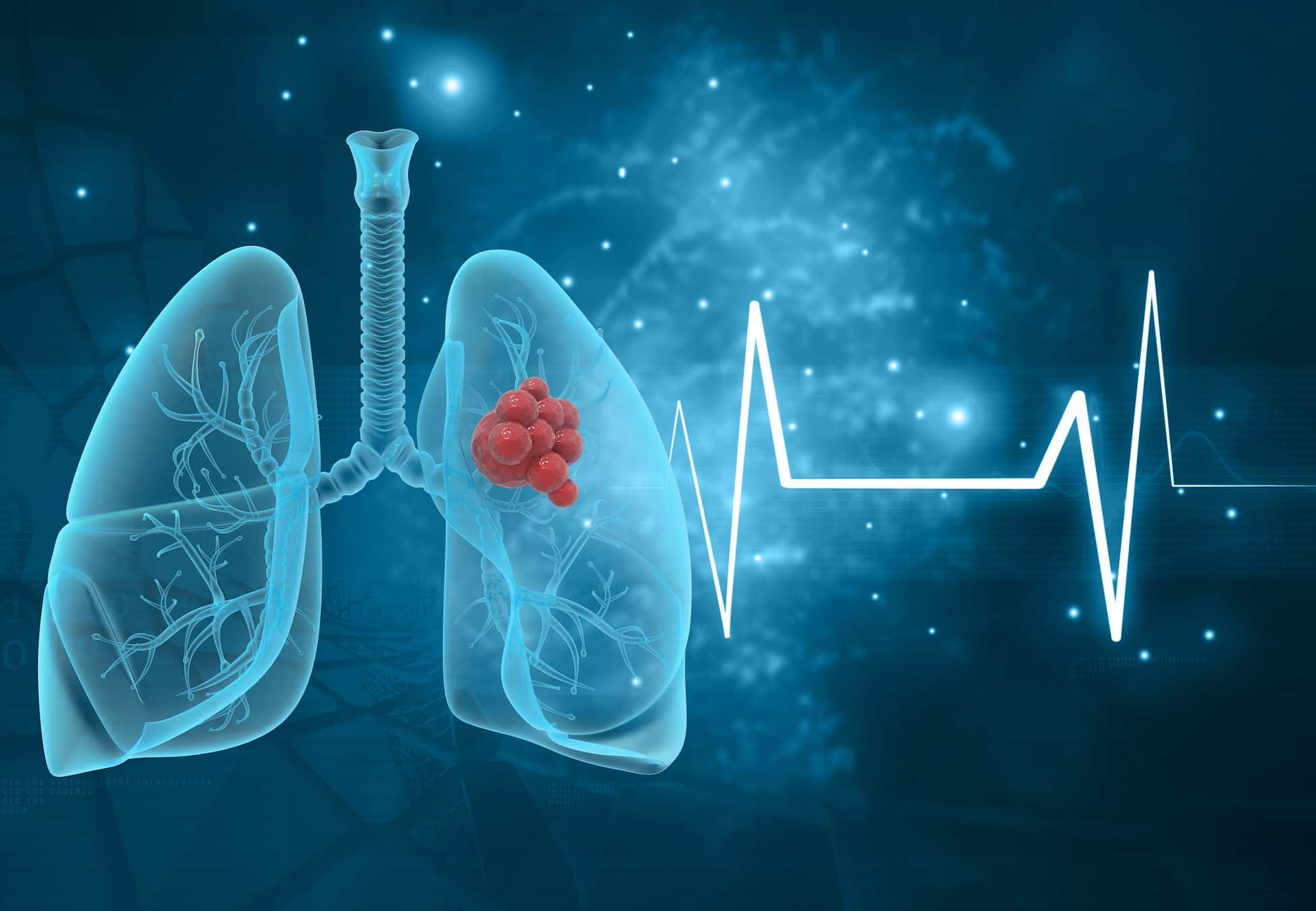 lung-biopsy