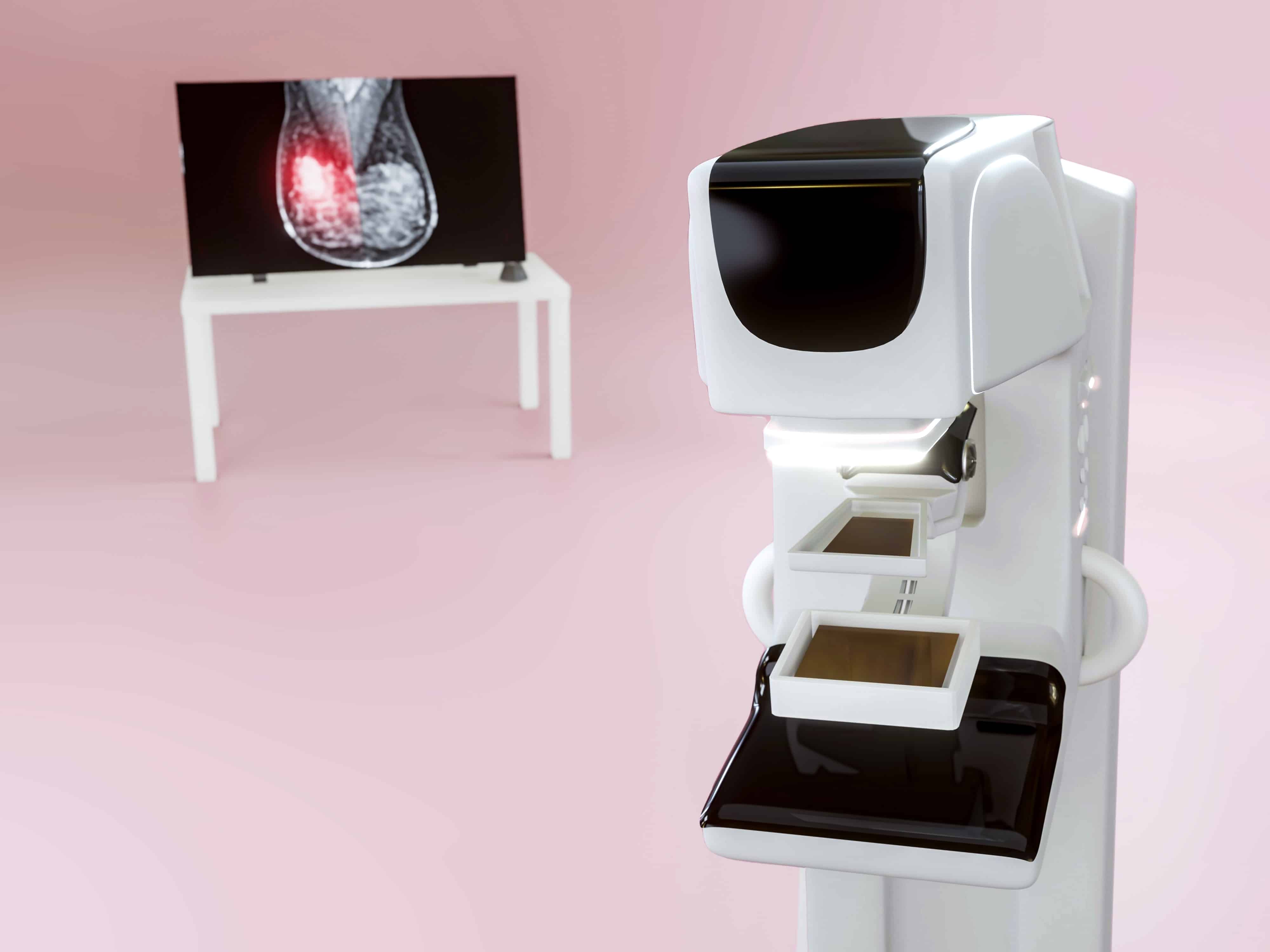 mammogram-techniques