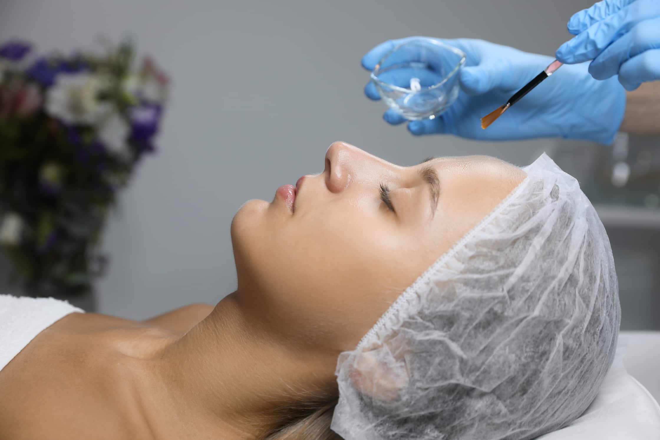 choosing the right level of chemical peel for you