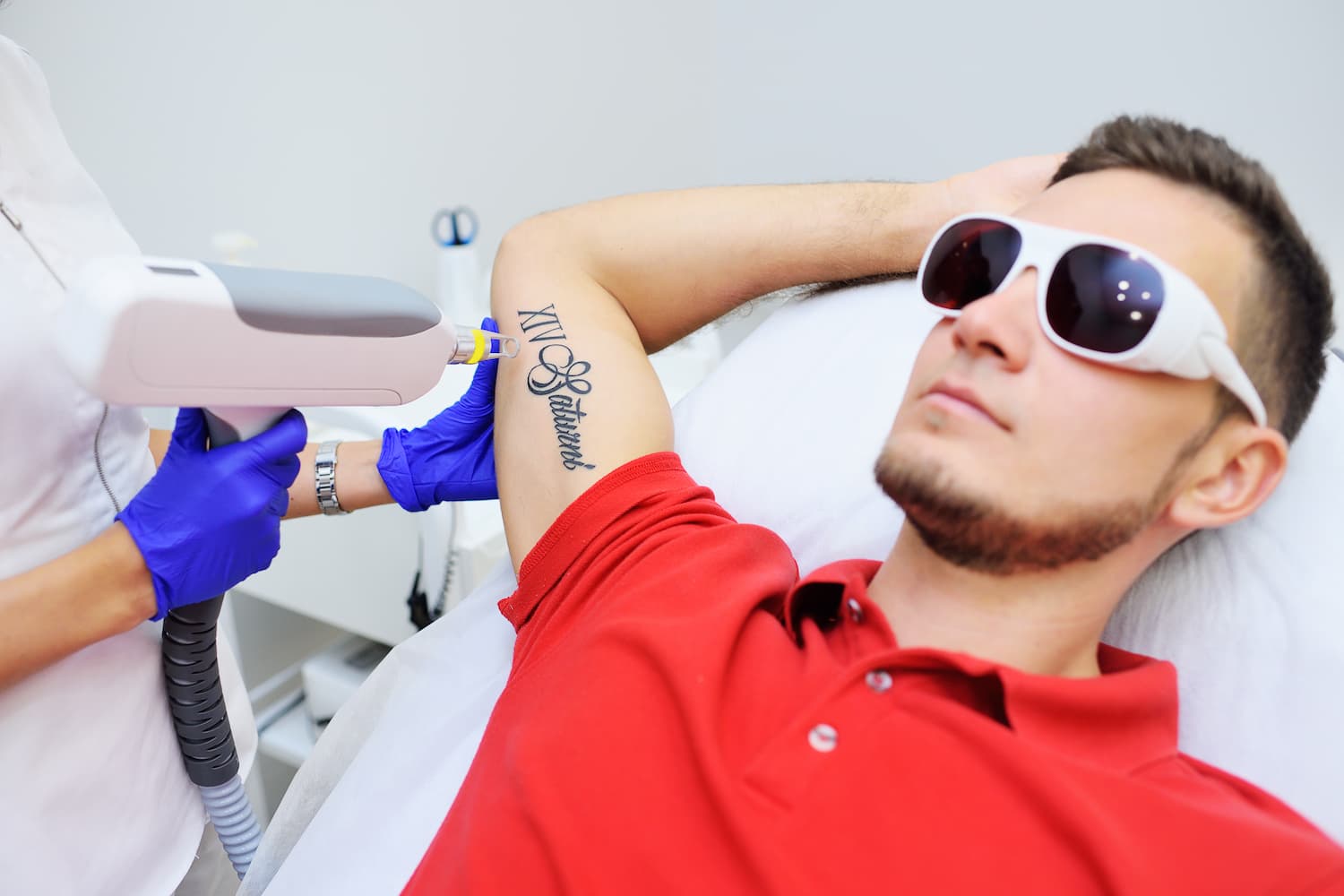 Tattoo Removal Aftercare: Tips and Tricks