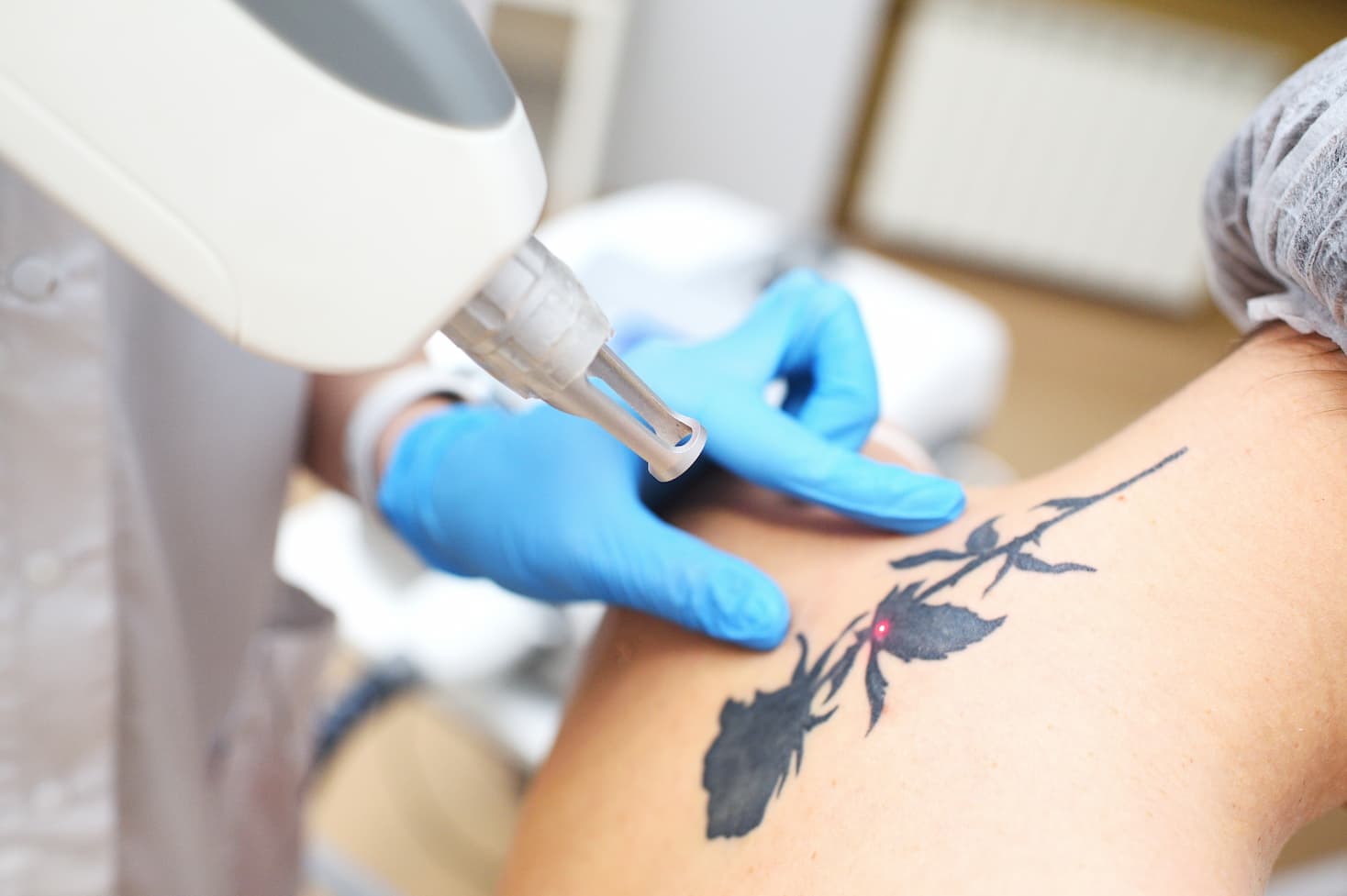 tattoo-removal-aftercare