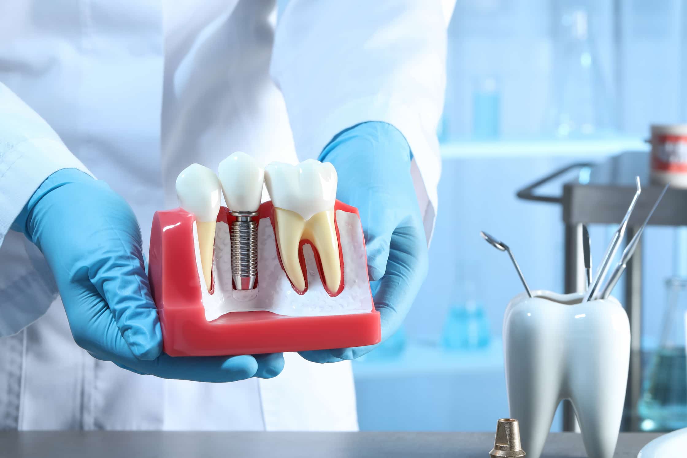 The Best Country for Dental Implants