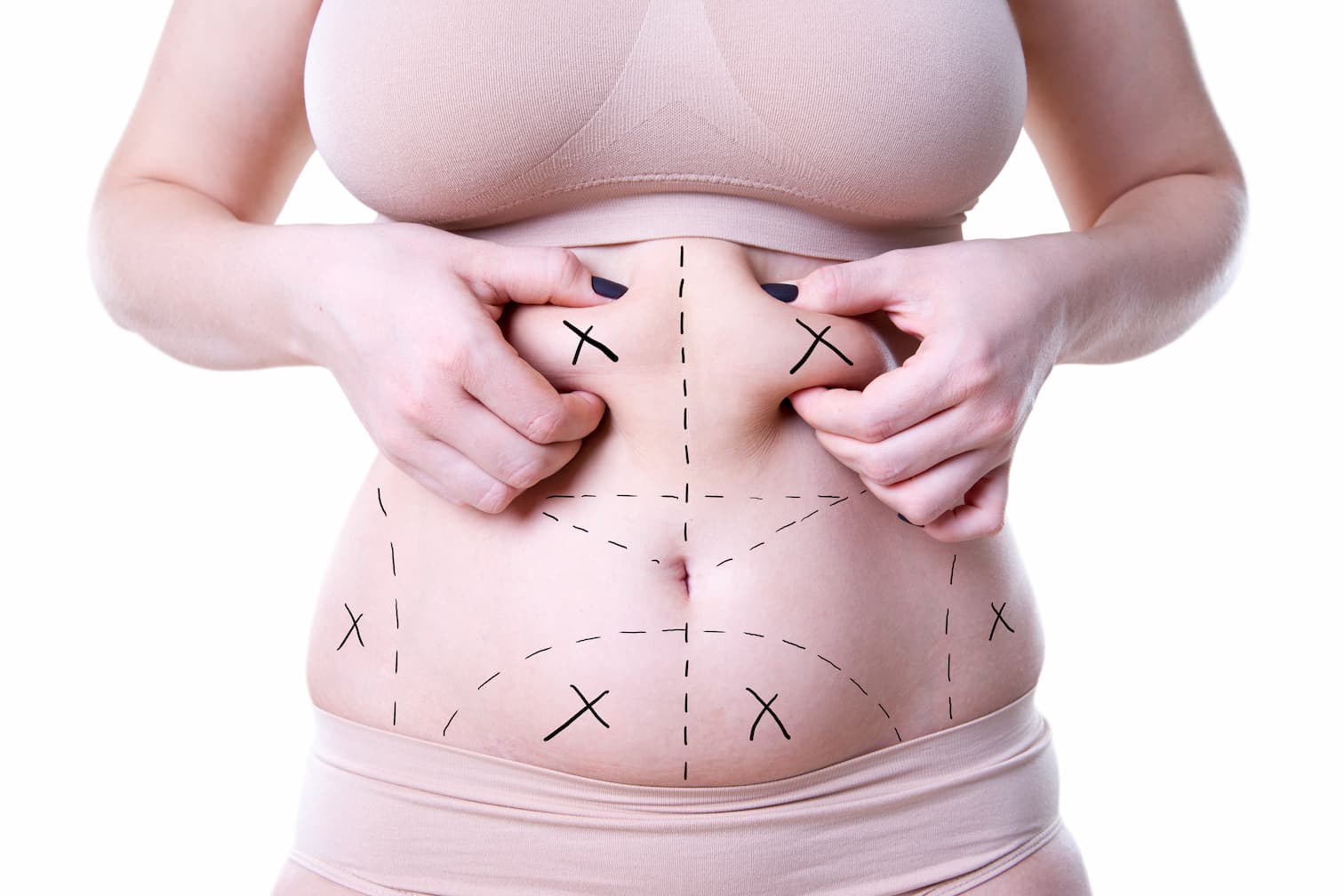 plus-size-tummy-tuck