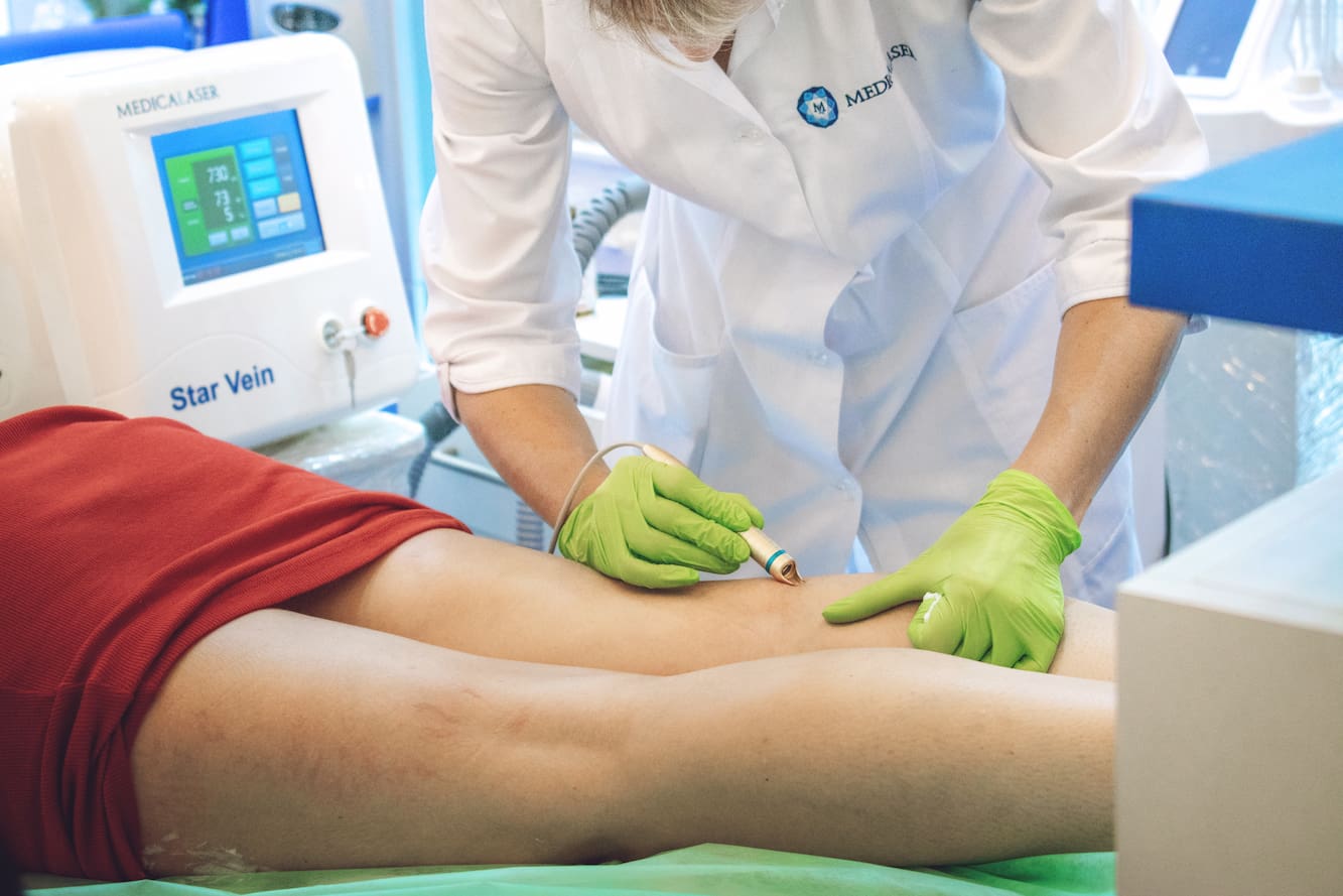 Turkiye laser veins memoval treatment procedure
