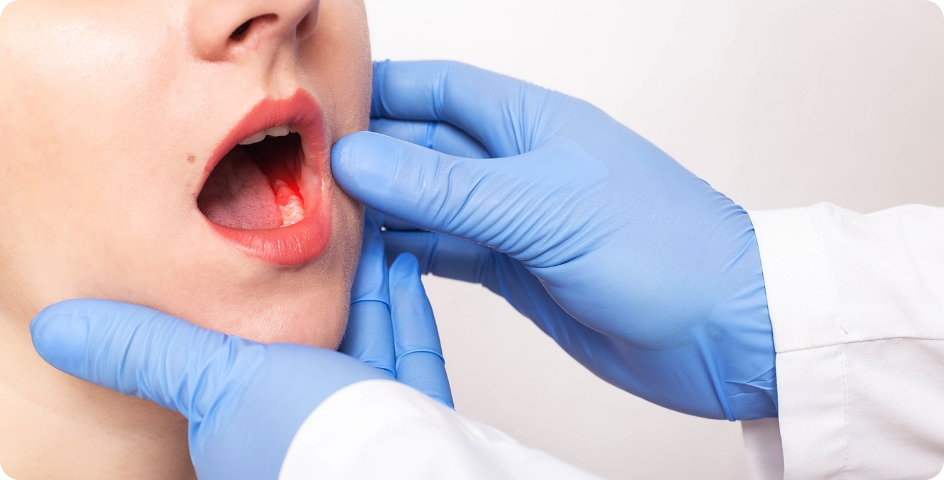 Procedimiento de tratamiento del cáncer de boca turquía