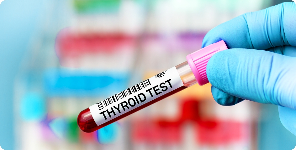 Procedimiento de tratamiento del cáncer de tiroides turquía