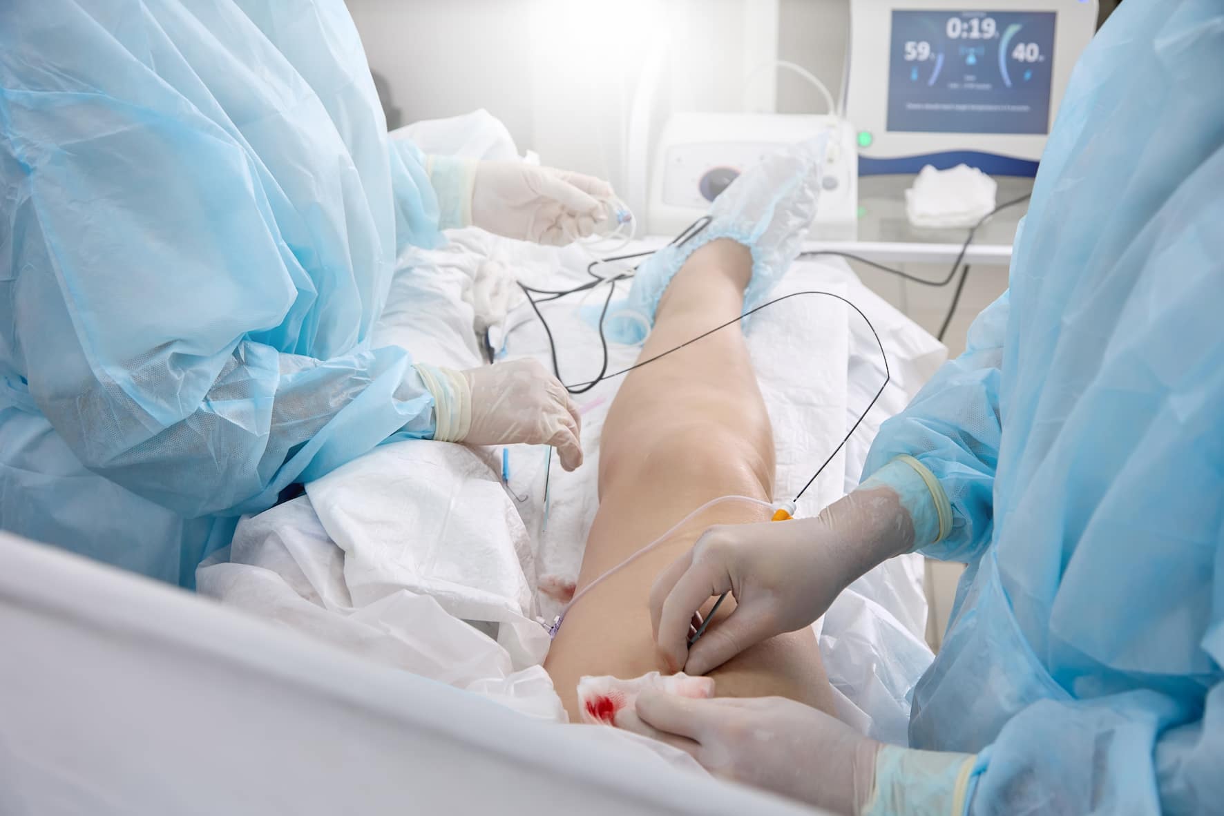 Turkiye cardiac ablation treatment
