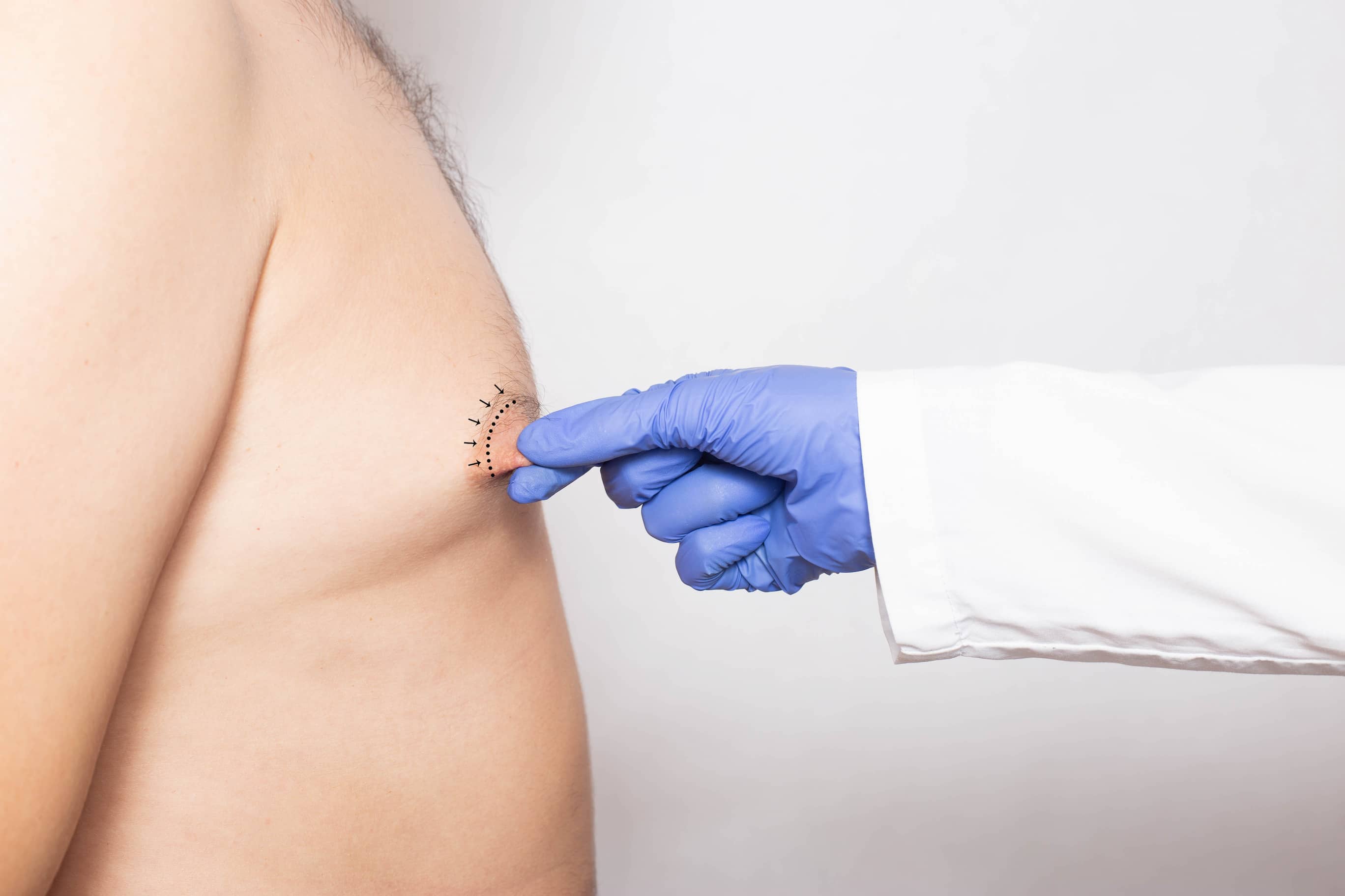 Turkey nipple reduction surgery