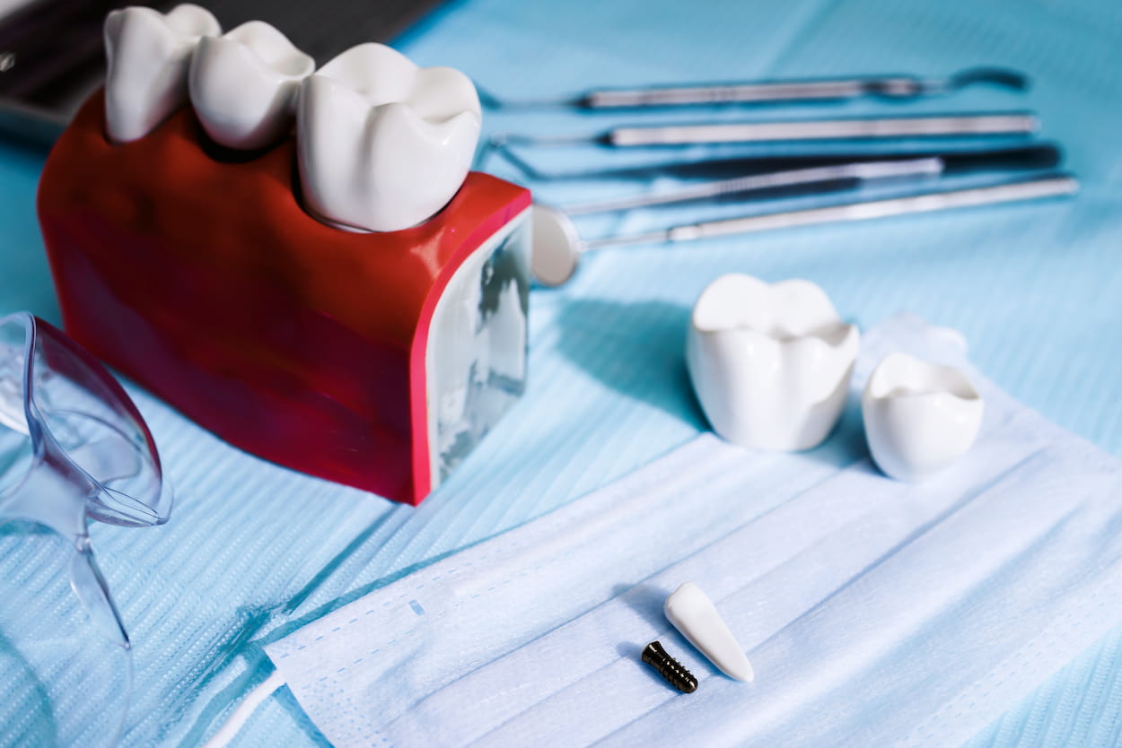 Turkiye dental care treatment procedure