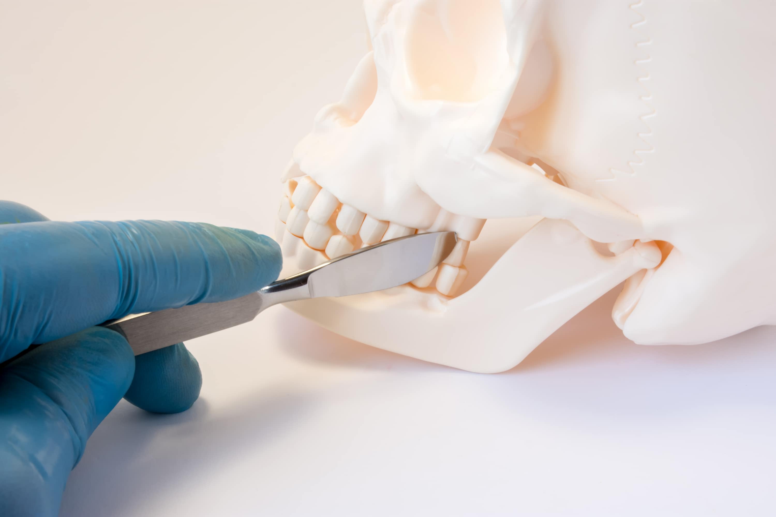 Cirugía de mandíbula turquía