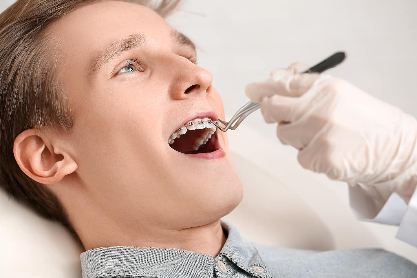 Процедура лечения зубов брекетами в турции