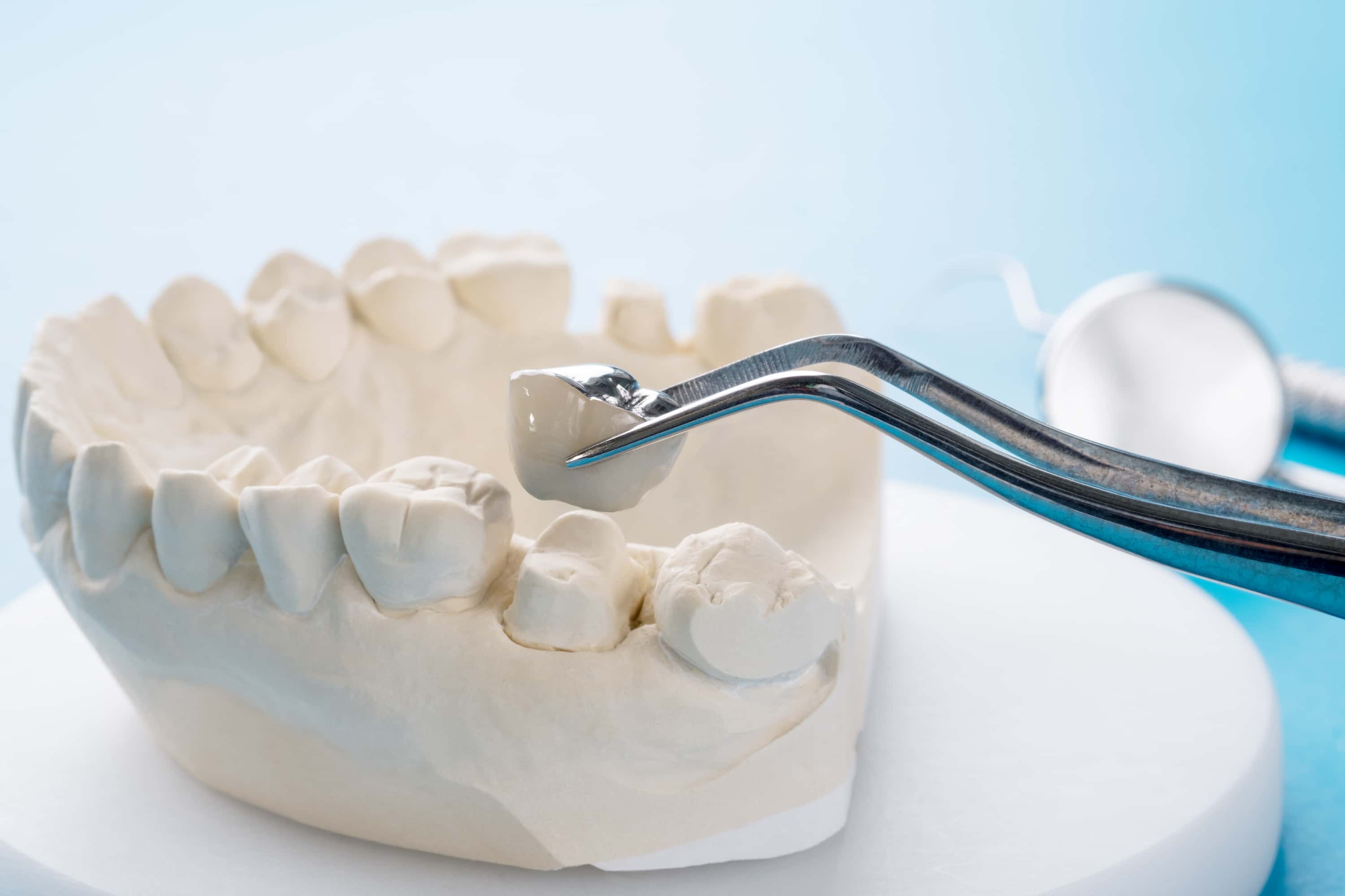 Turkiye dental crowns procedure
