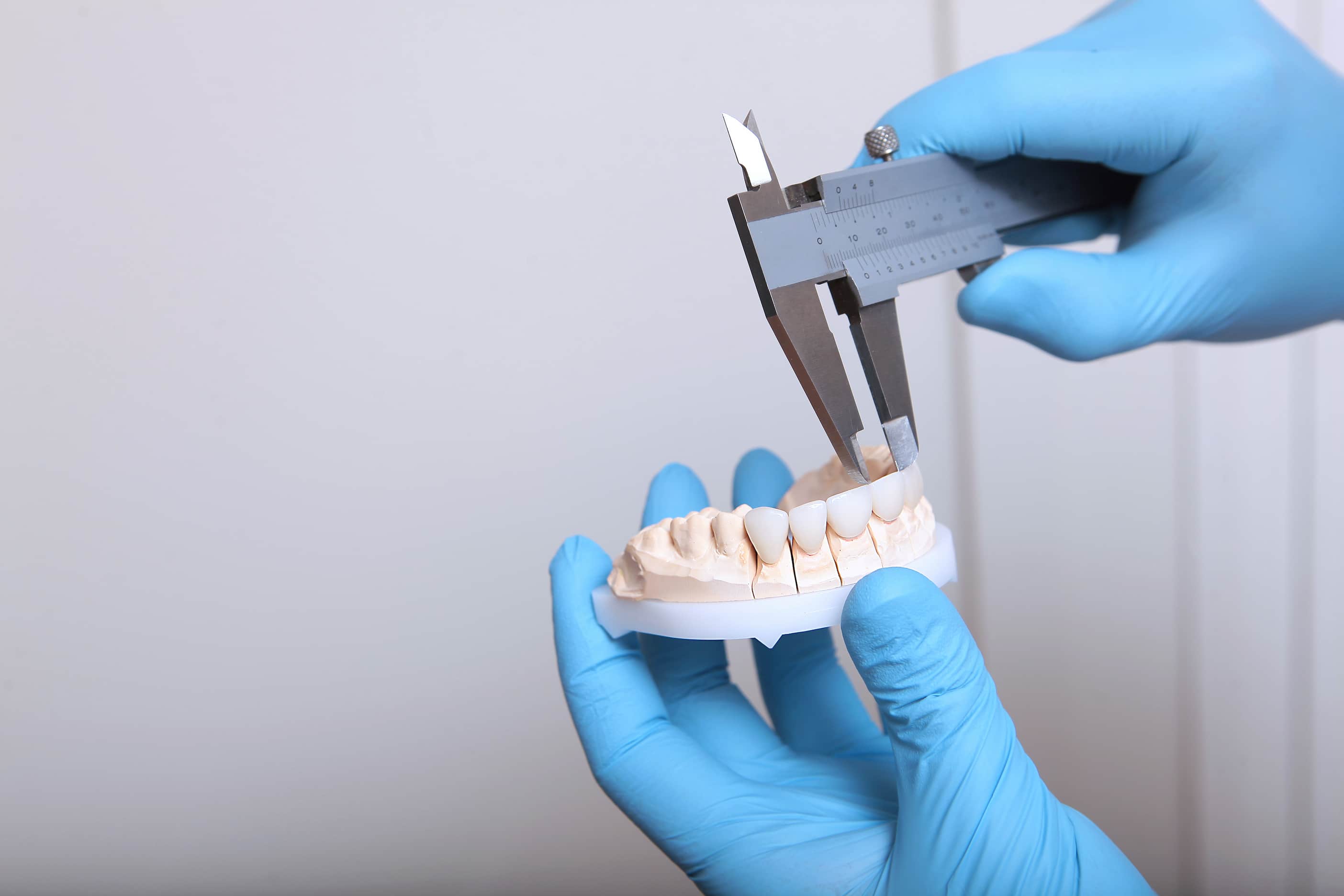 Turkiye dental bonding
