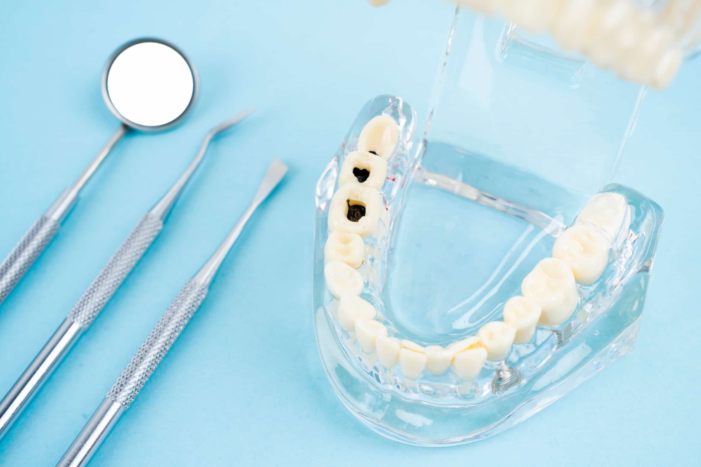 Turkiye tooth filling procedure