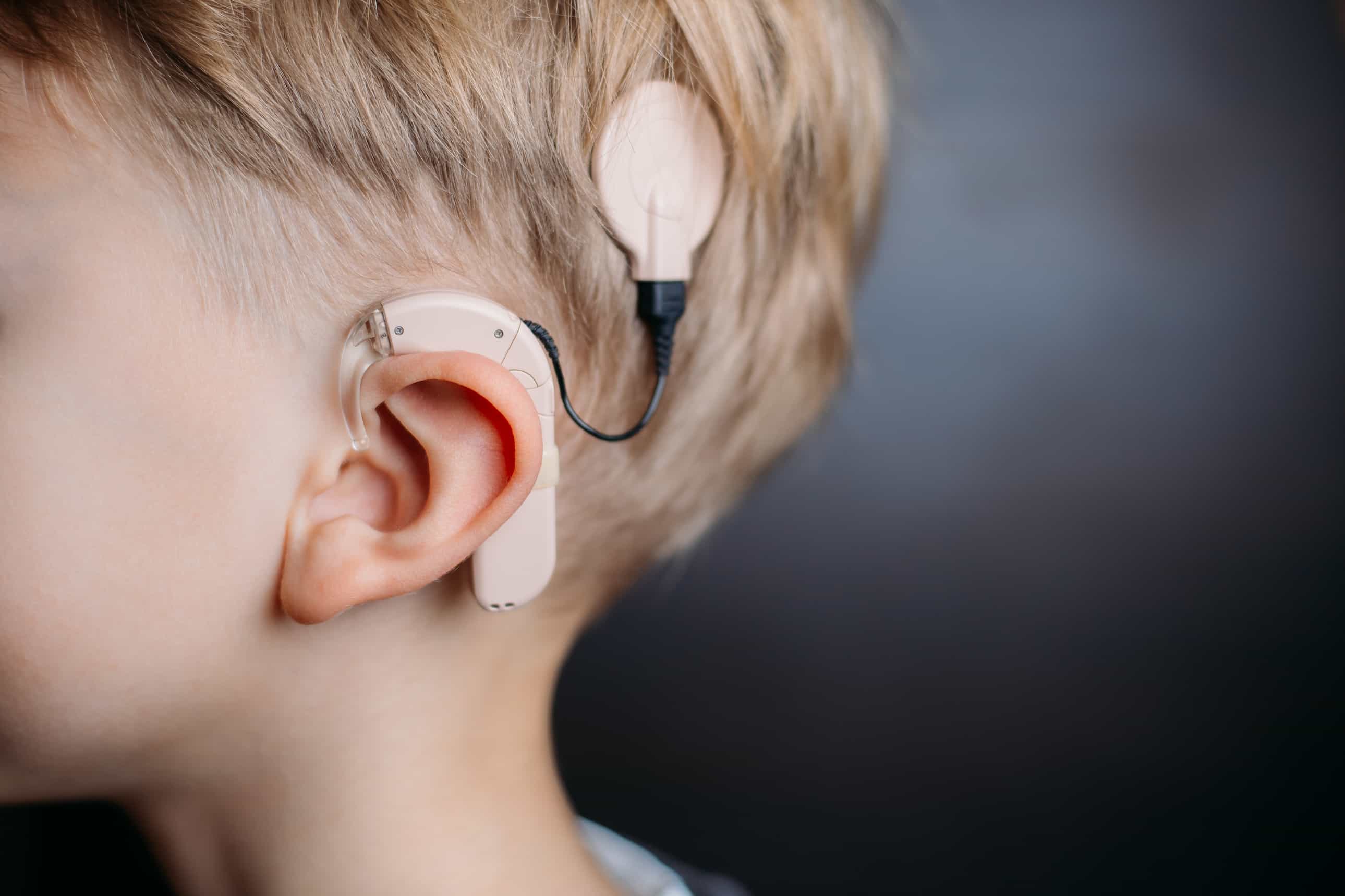 Cochlear implant turkiye