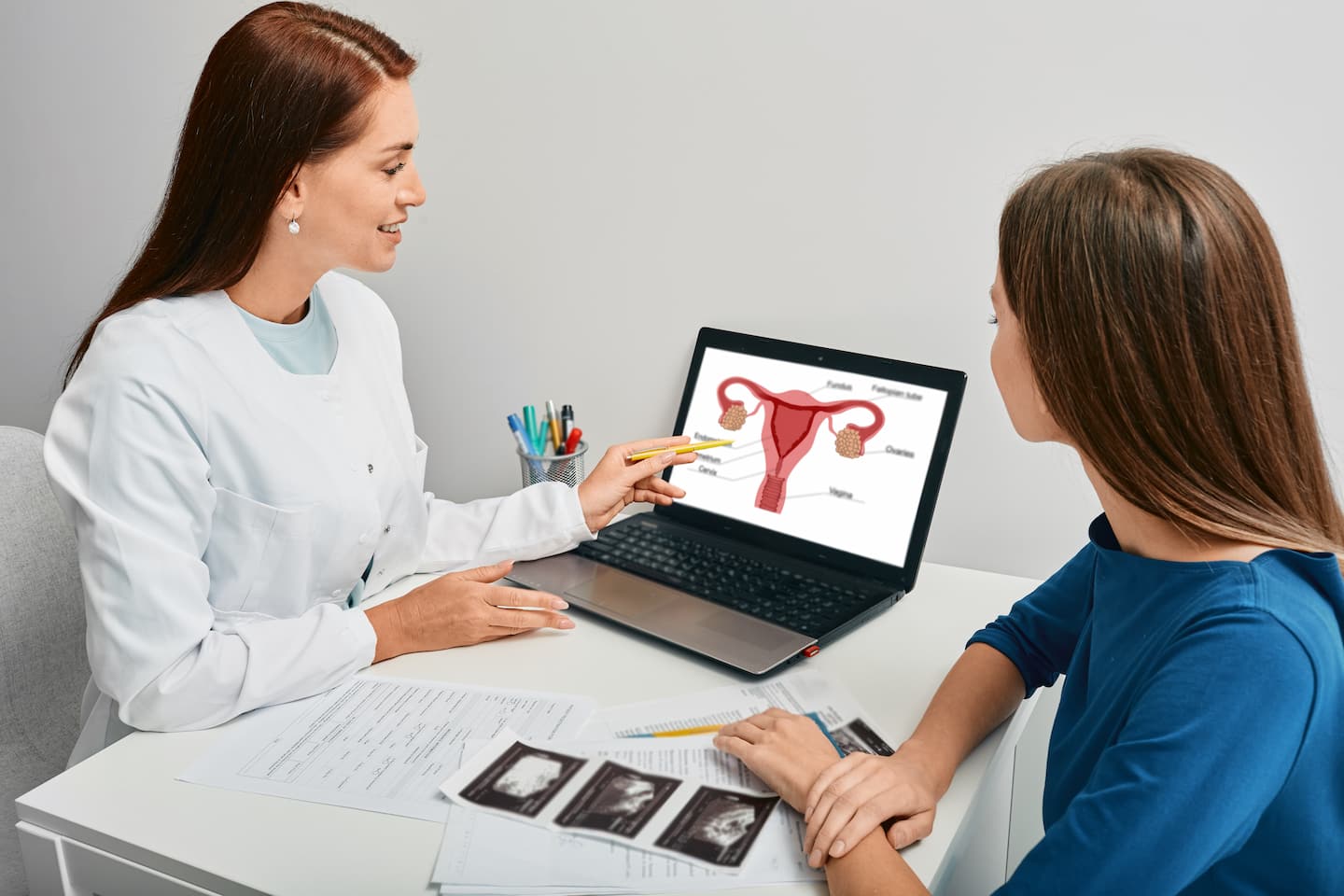 Procédure de traitement du syndrome des ovaires polykystiques turquie