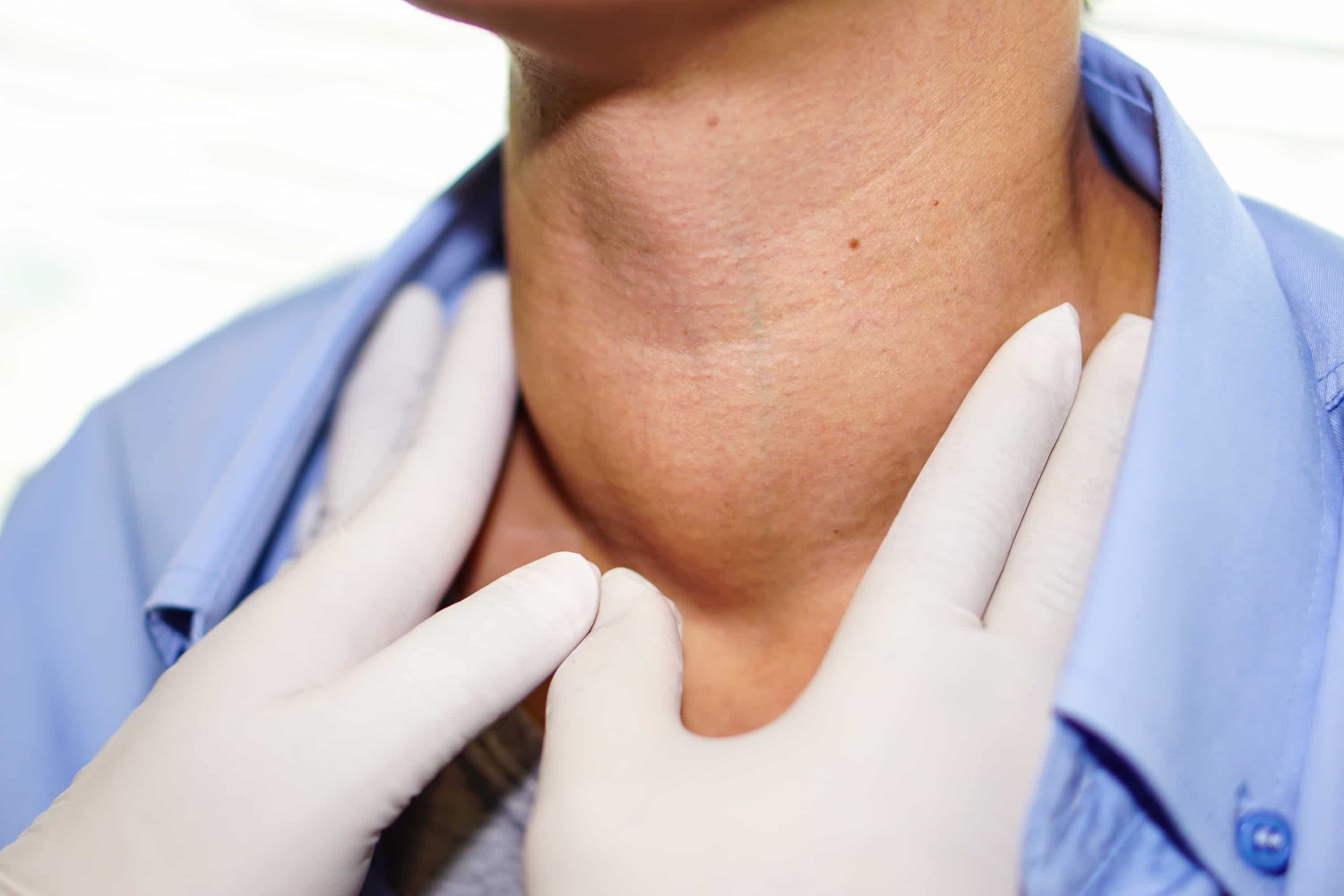 Thyroid disease treatment turkiye