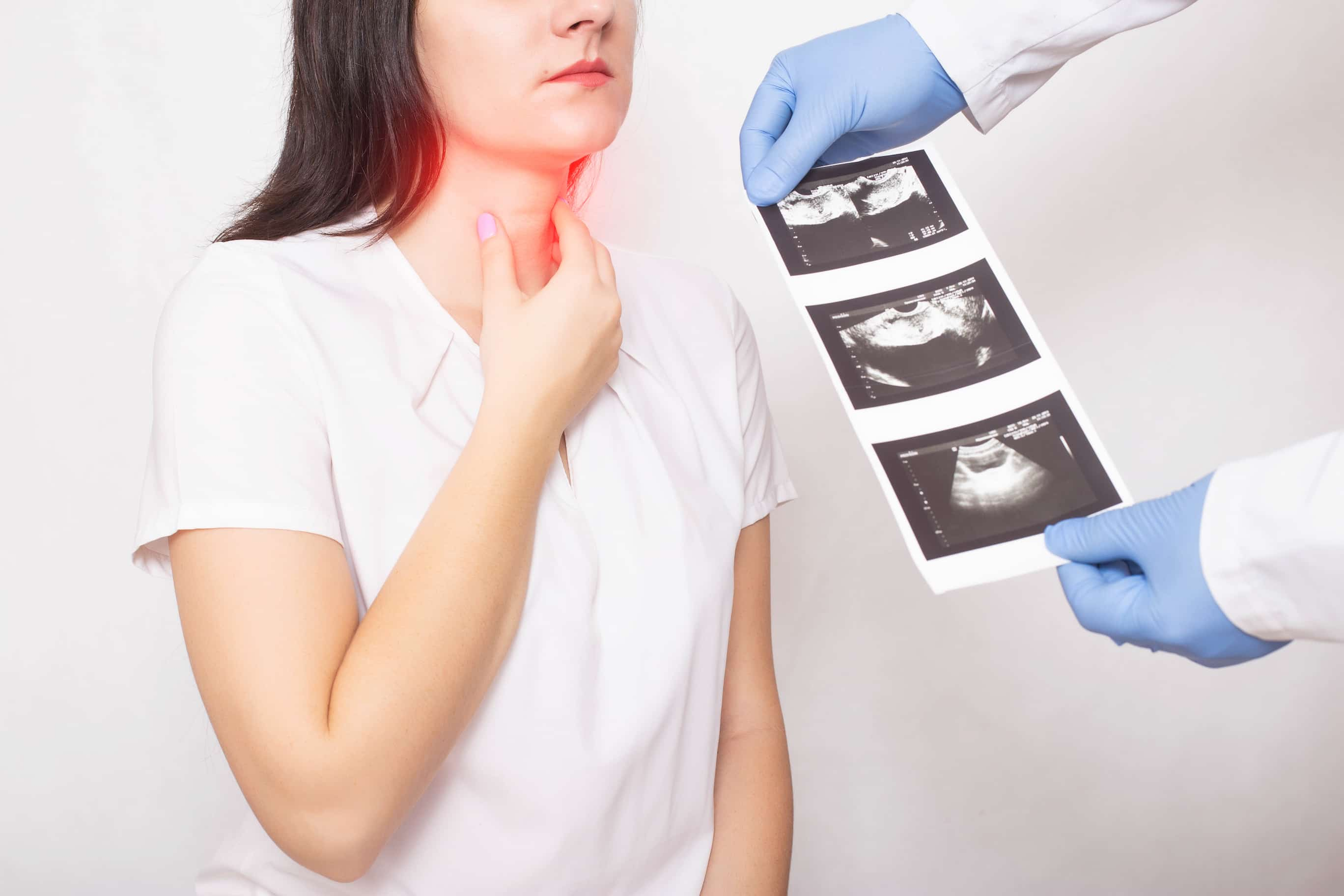 Hypothyroidism treatment turkiye