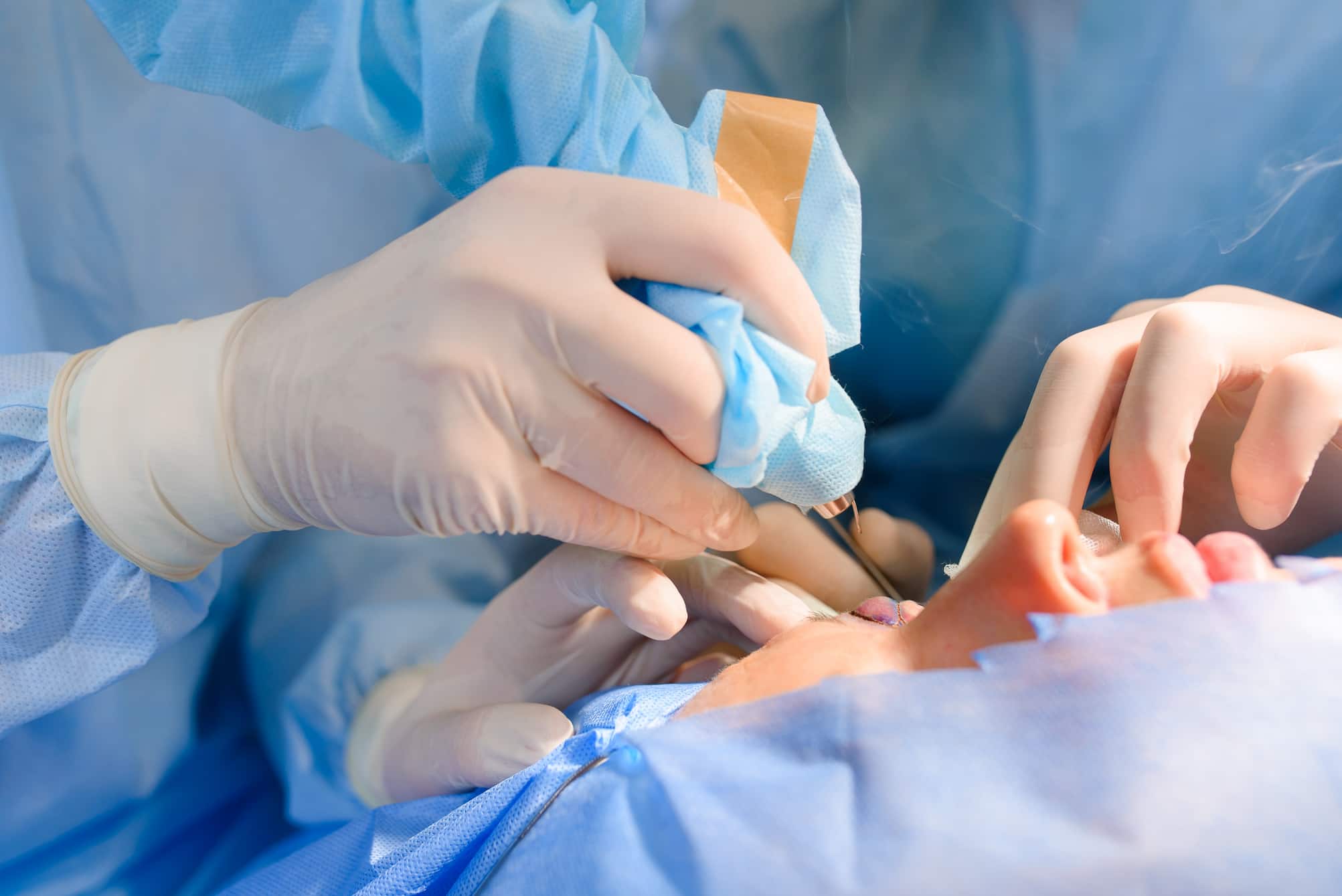 Chirurgie plastique oculofaciale en turquie