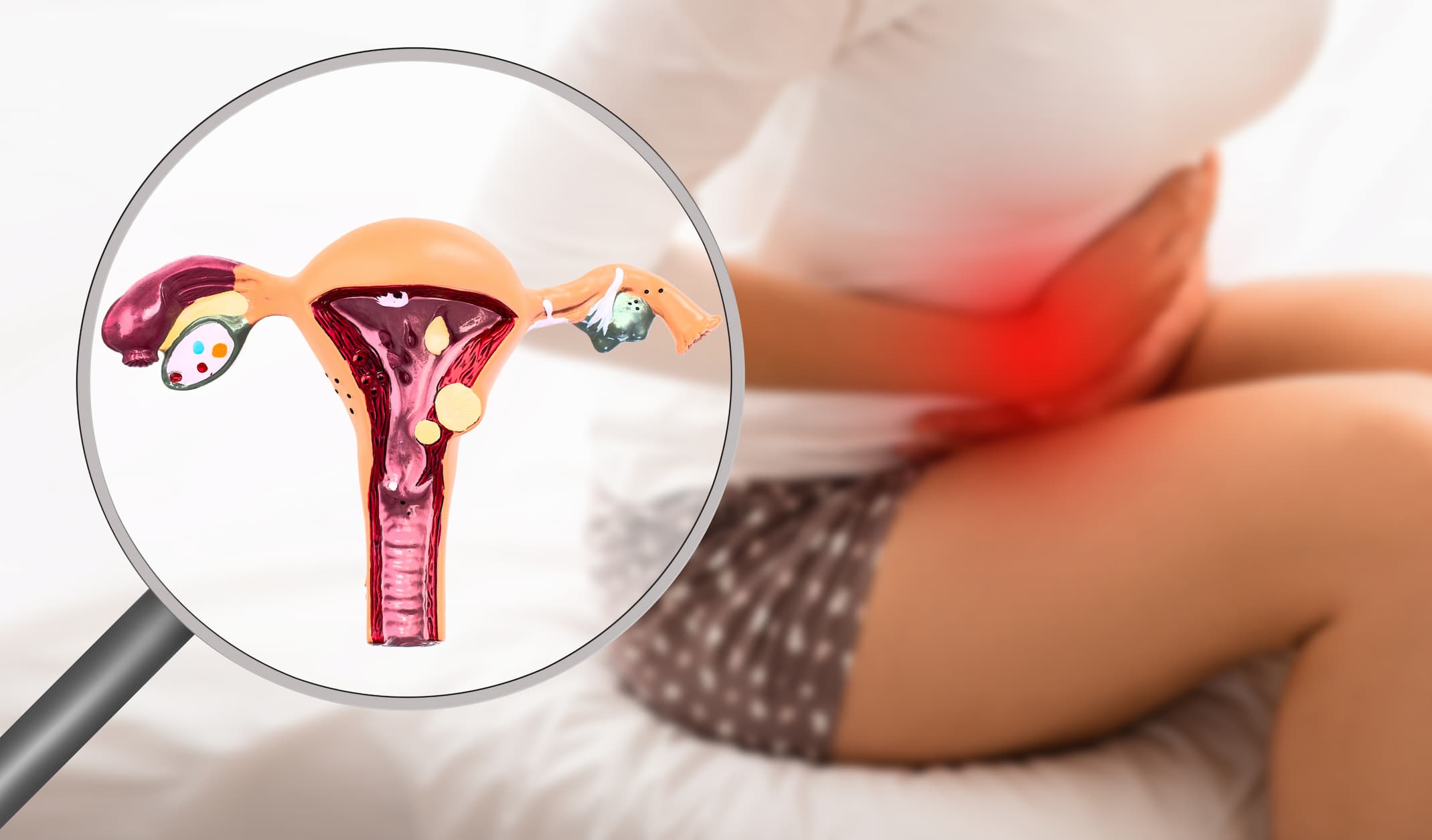 Endometriosis treatment turkiye