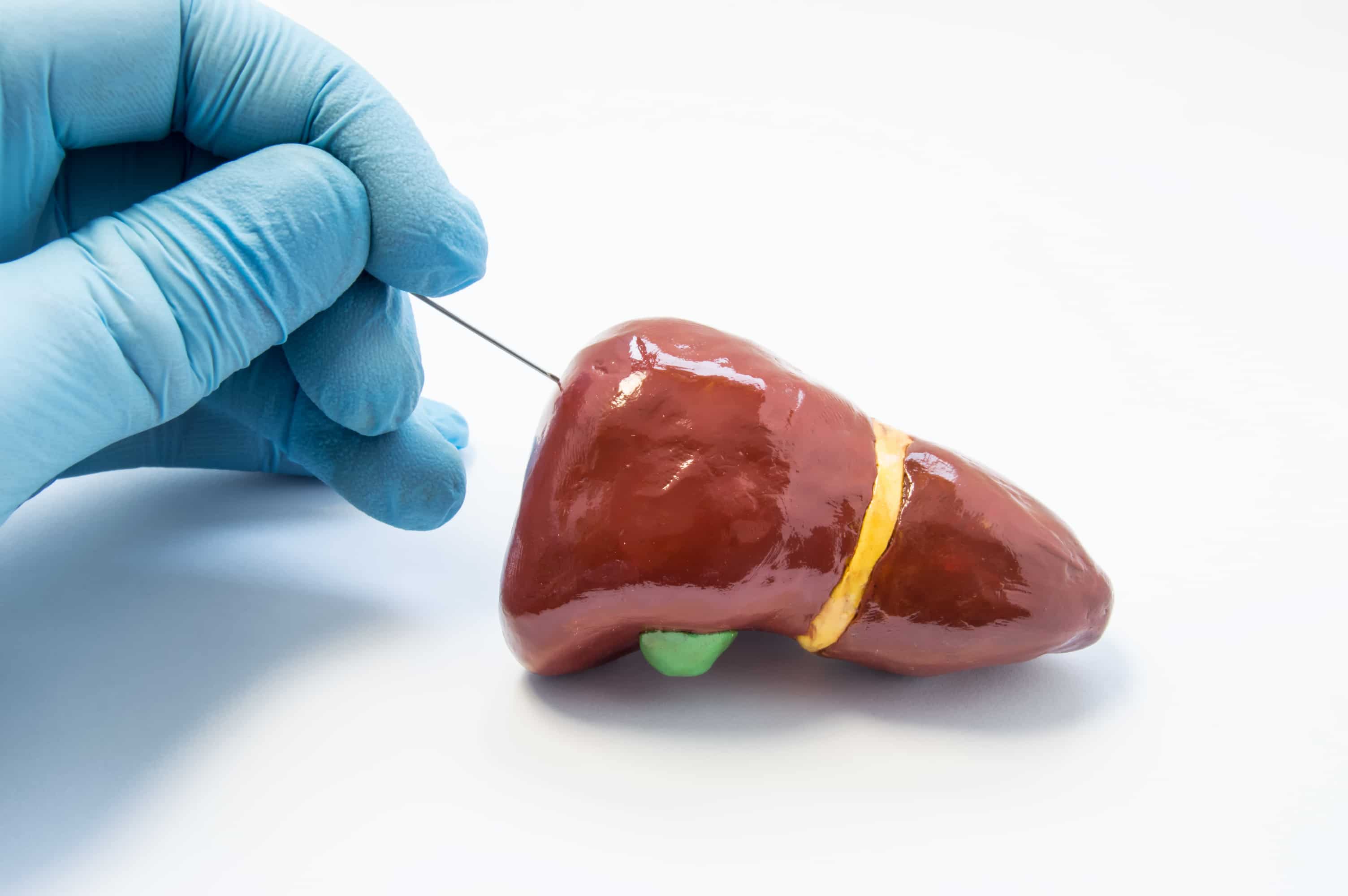 Liver biopsy turkiye