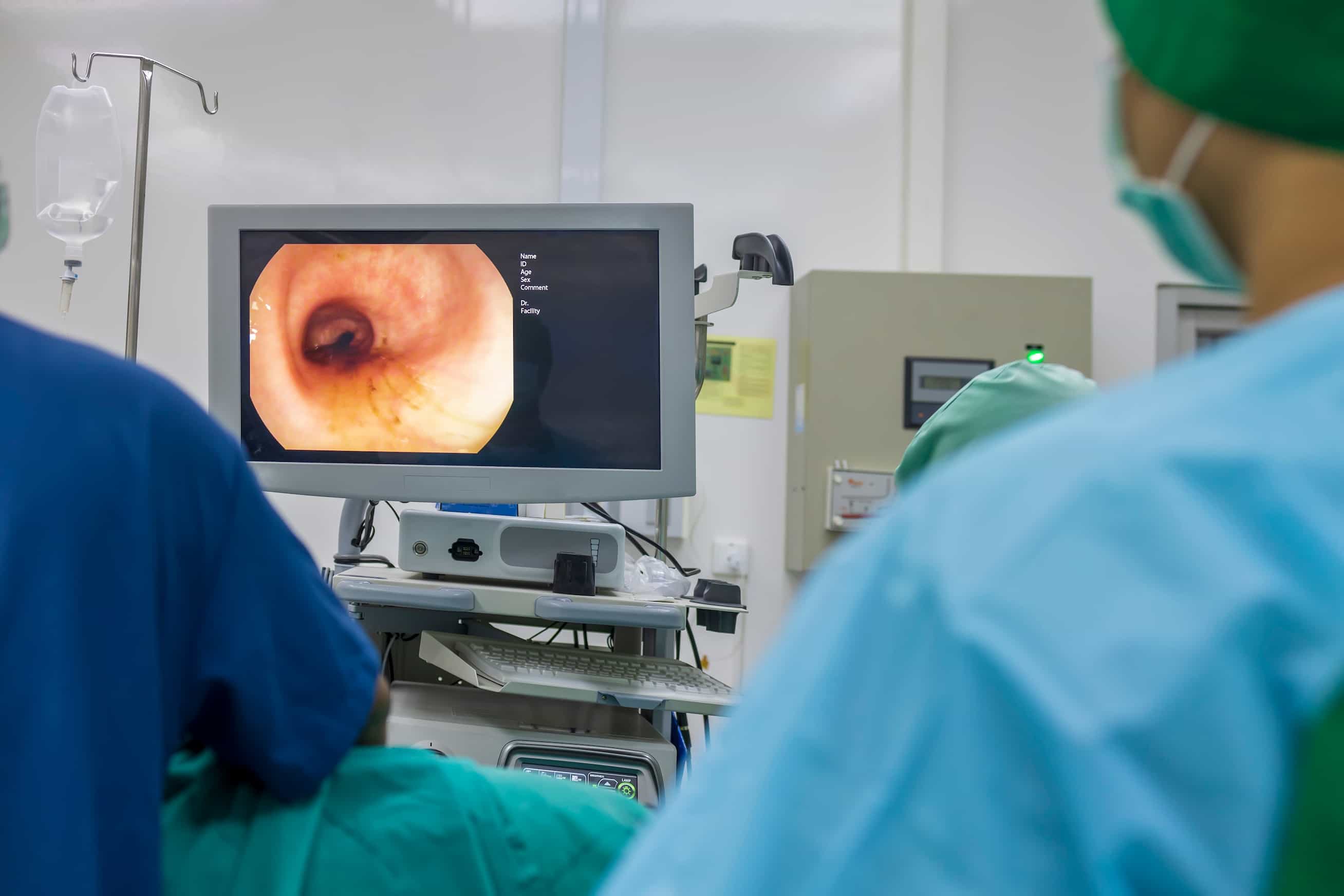 Turkiye gi endoscopy procedure