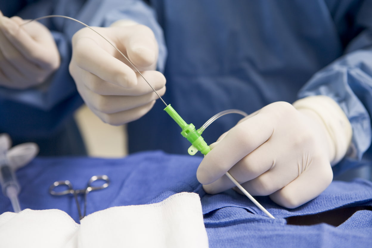 Turkiye general surgery procedure