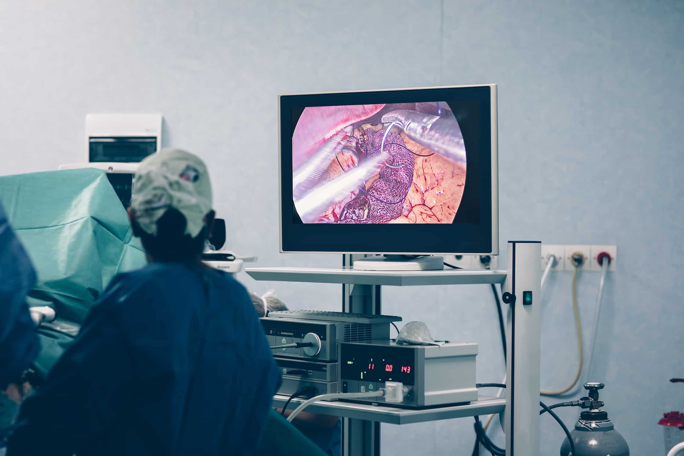 Procédure de gastrectomie laparoscopique en manchon de turquie
