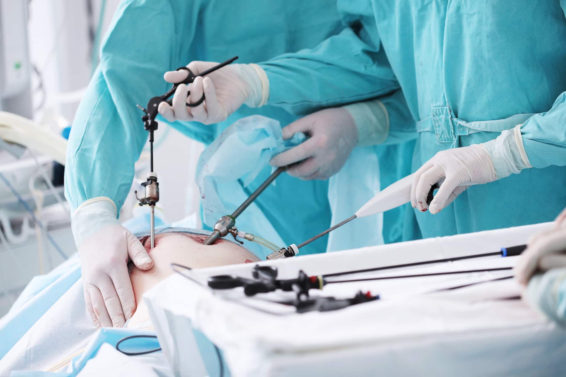Laparoscopic surgery turkiye