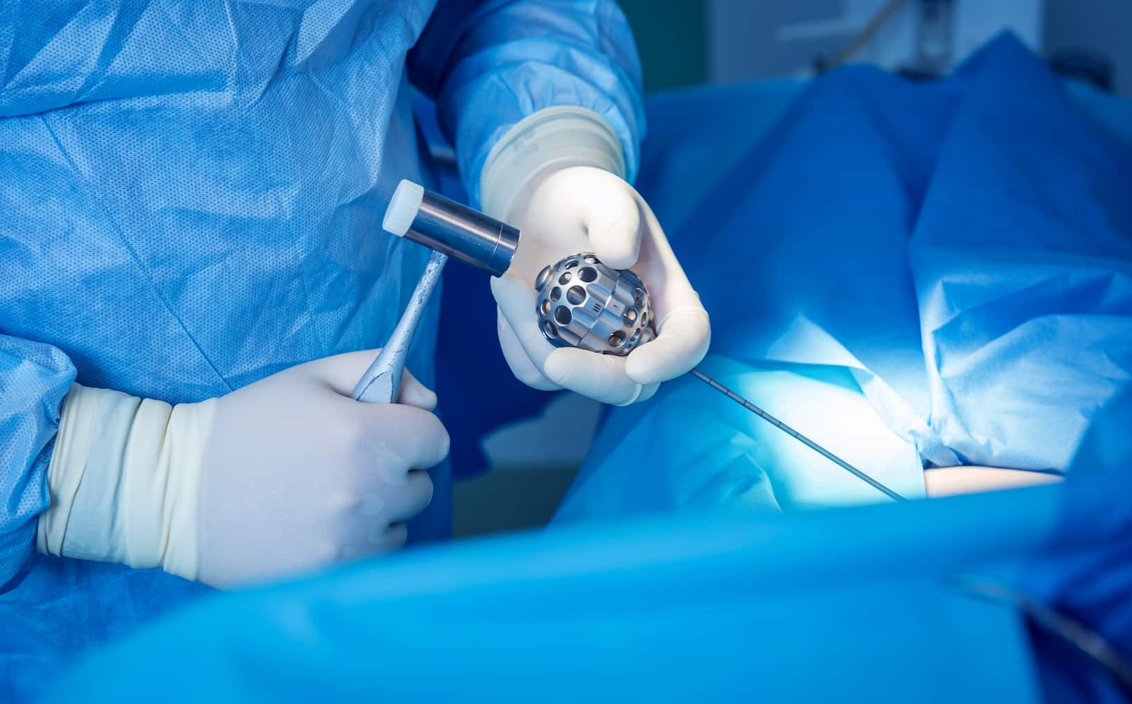 Procédure de chirurgie de la colonne vertébrale par microdiscectomie à turquie