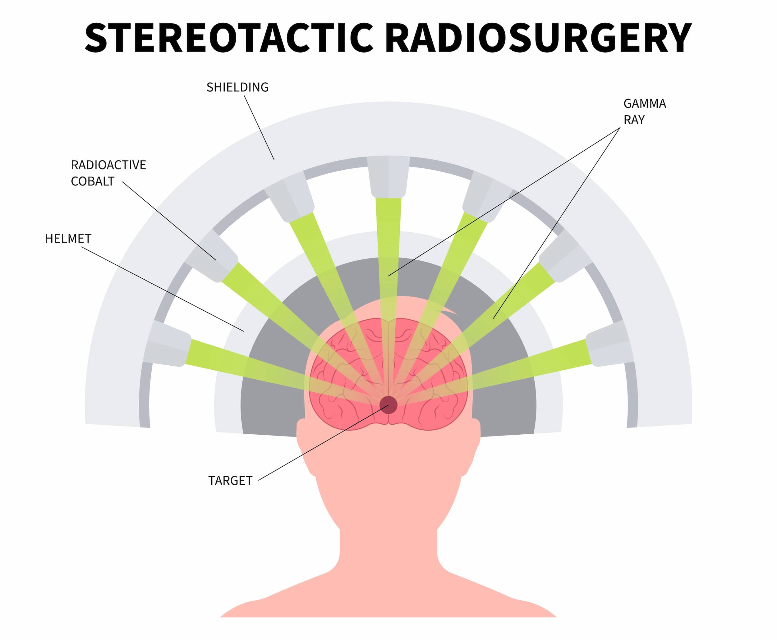 Turkiye stereotactic radiosurgery