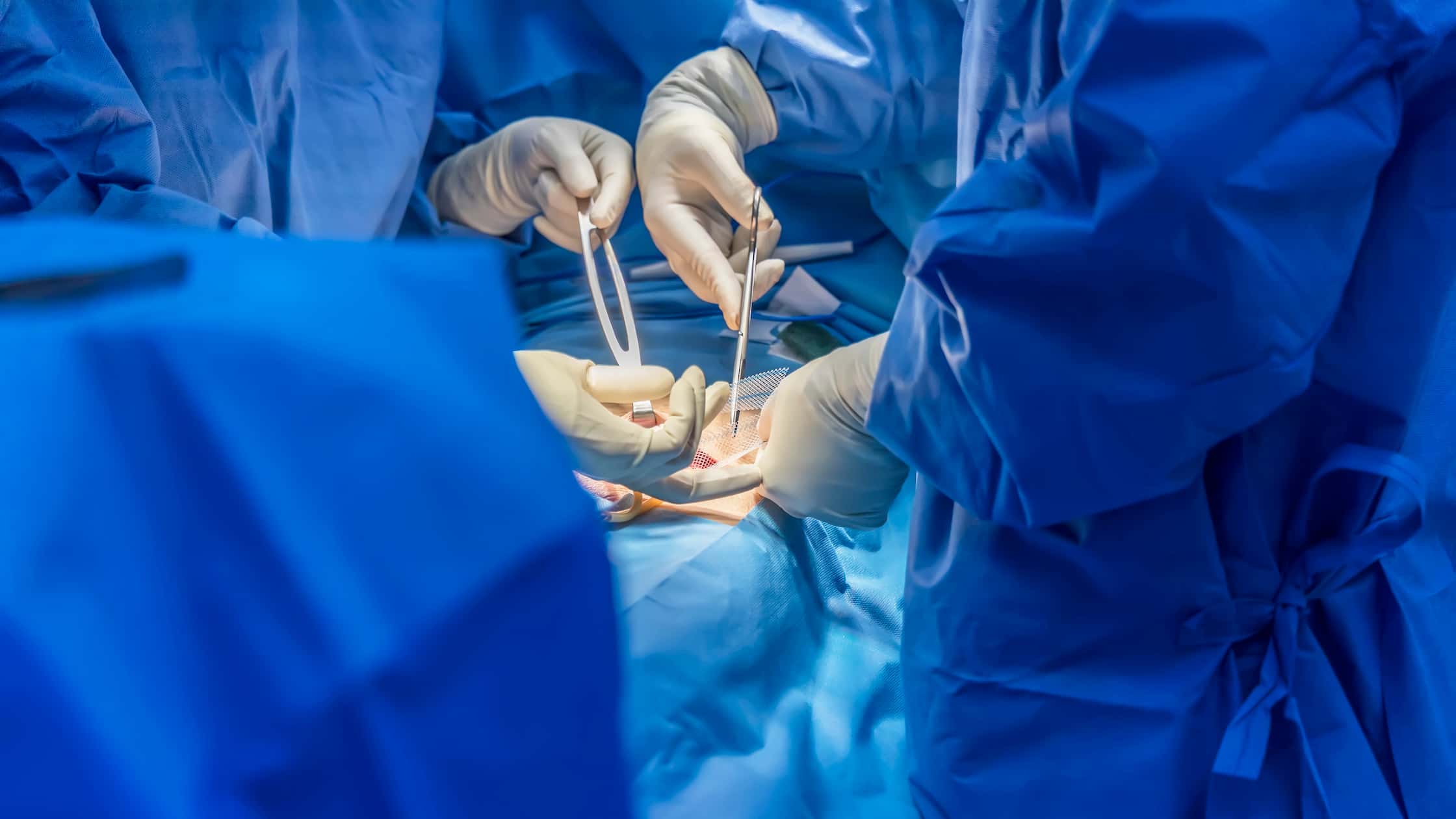 Turkiye exploratory laparotomy procedure