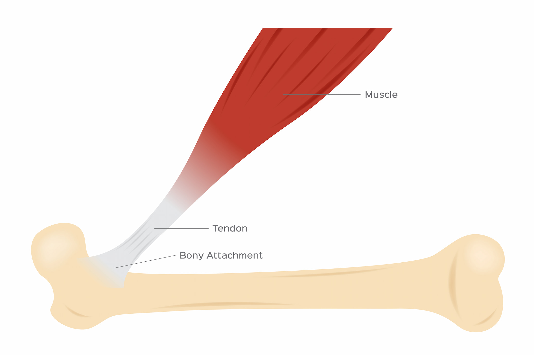 Turkiye tendon repair surgery procedure