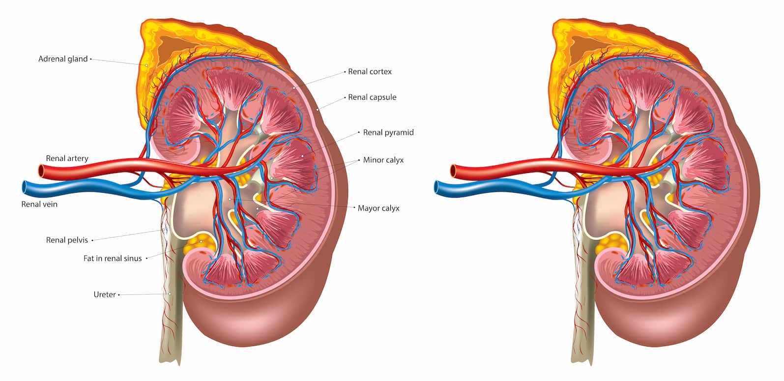 Renal artery stenosis treatment turkiye
