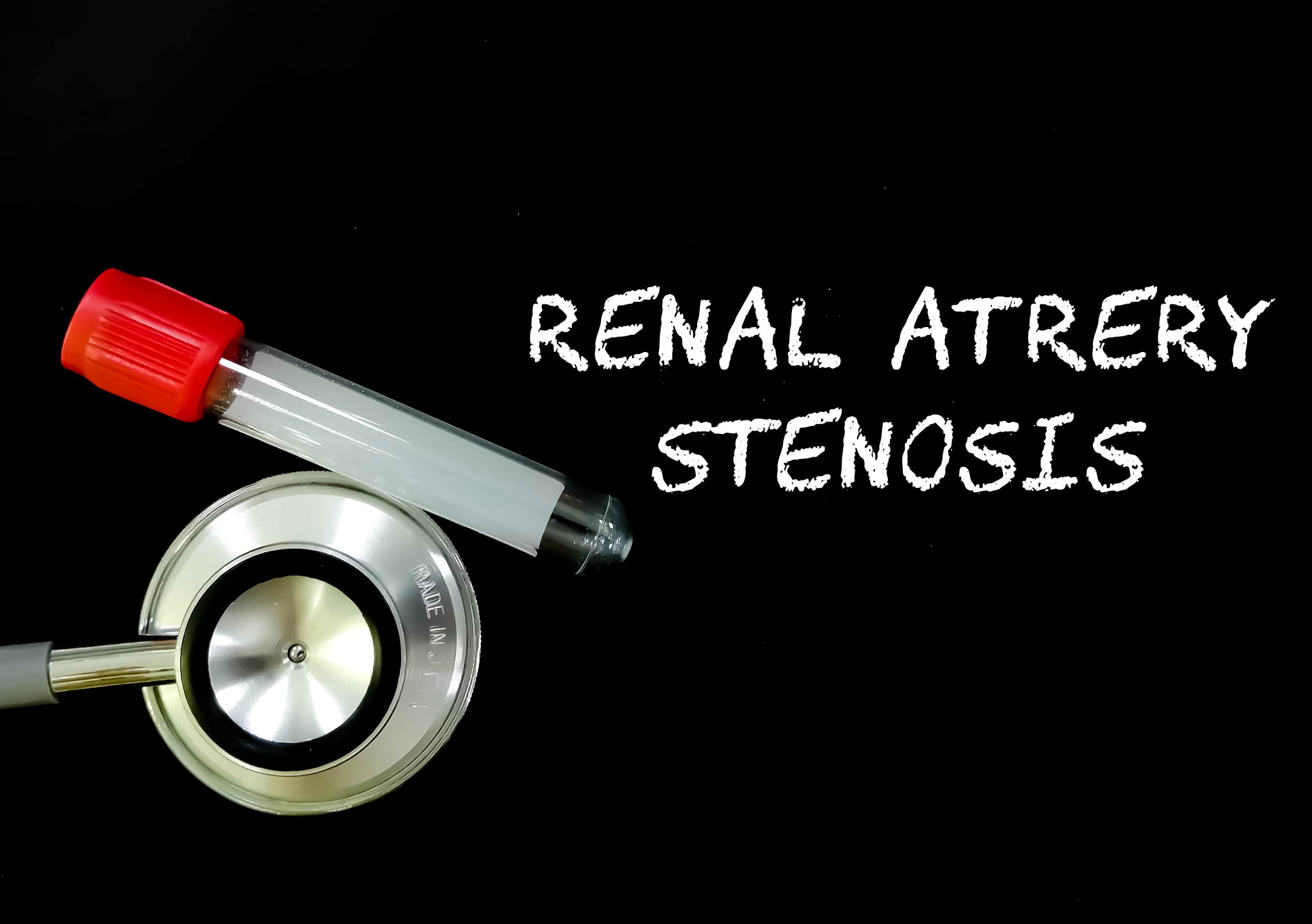 Turkiye renal artery stenosis treatment procedure