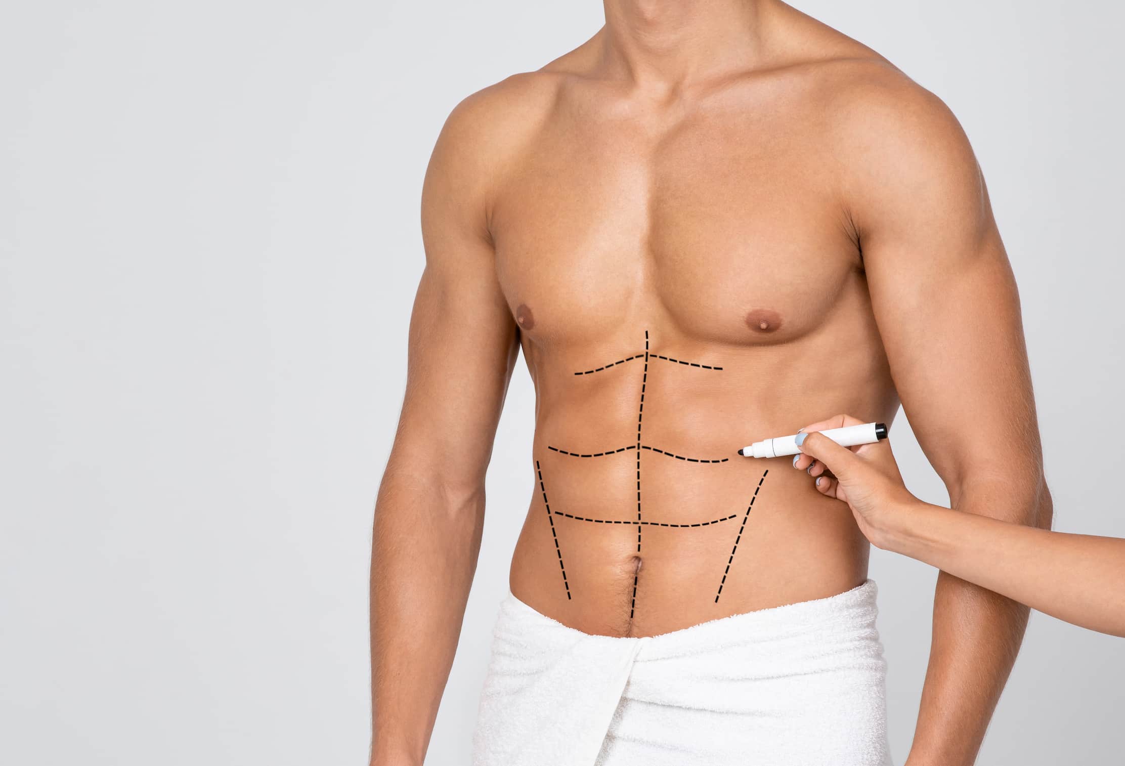 Cost of Abdominal Etching