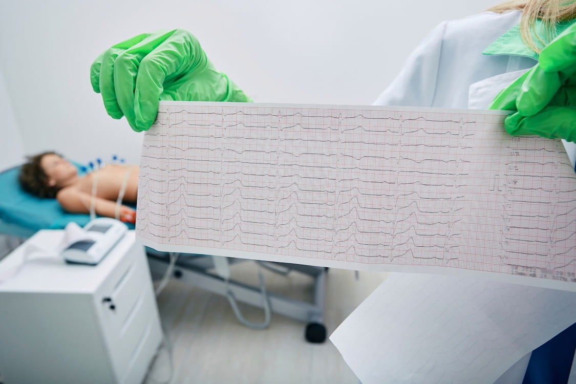 Normal Electrocardiography (ECG) Intervals