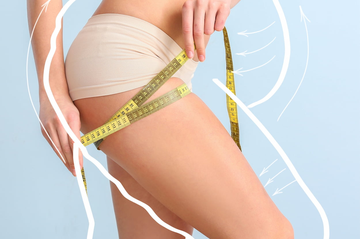 Fibrosis After Liposuction: Causes, Treatment, and Prevention