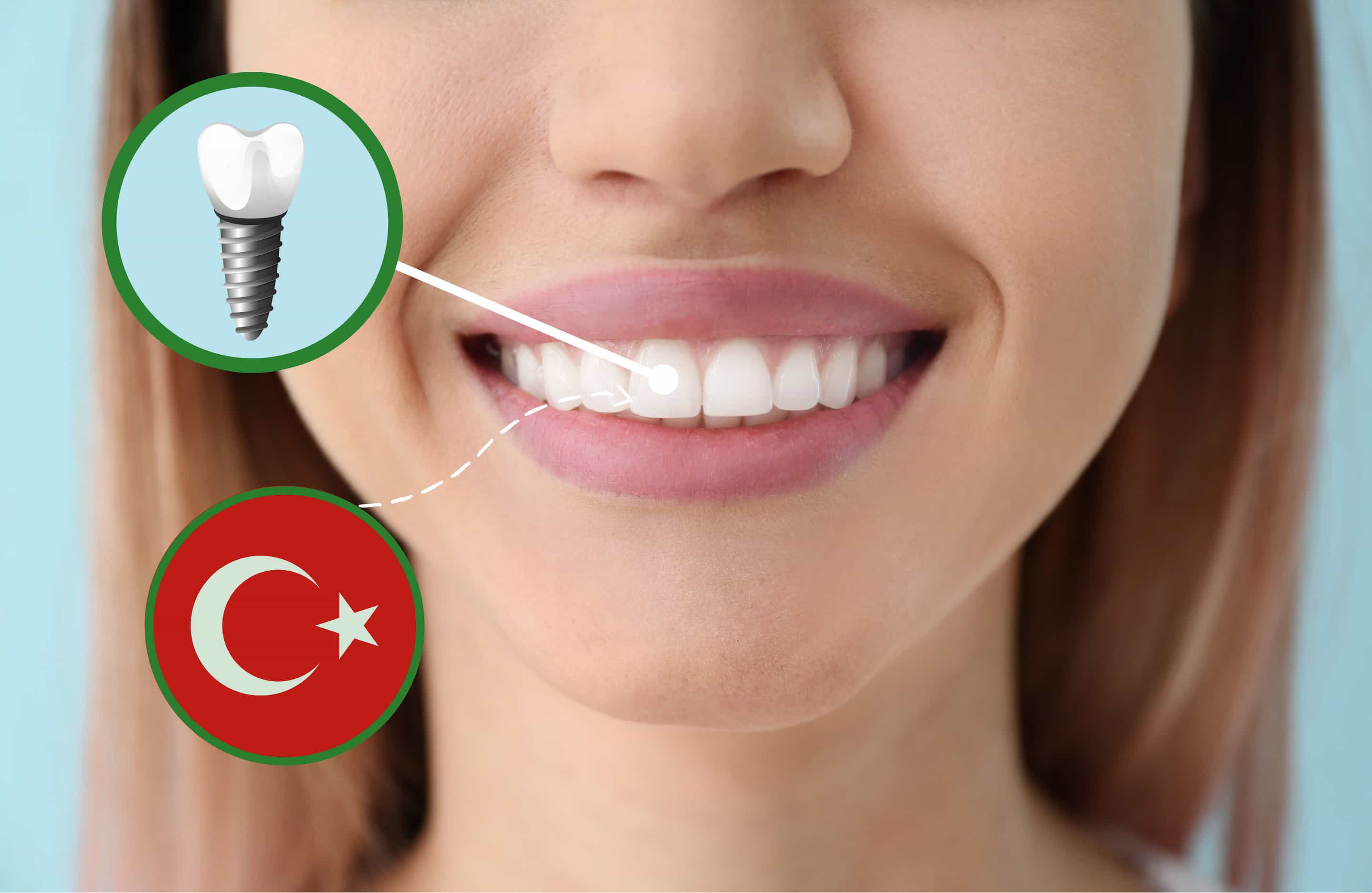 turkiye dental implants