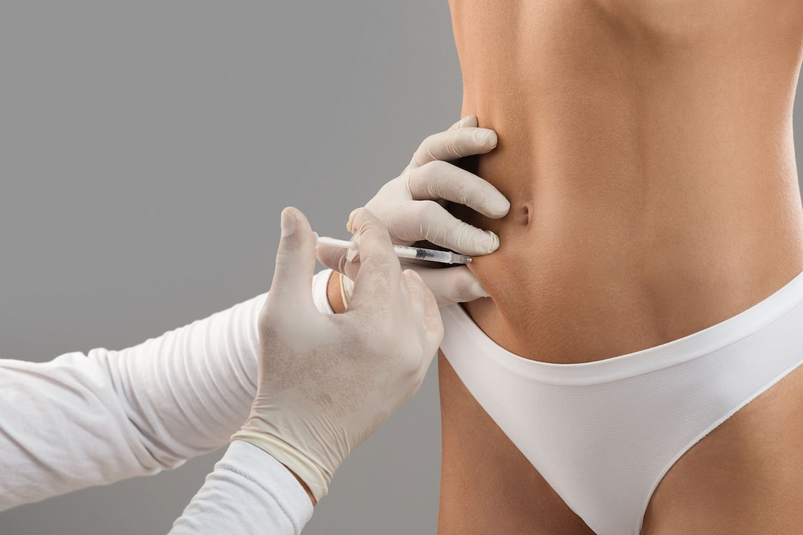 Everything You Need to Know About Fat Dissolving Injections