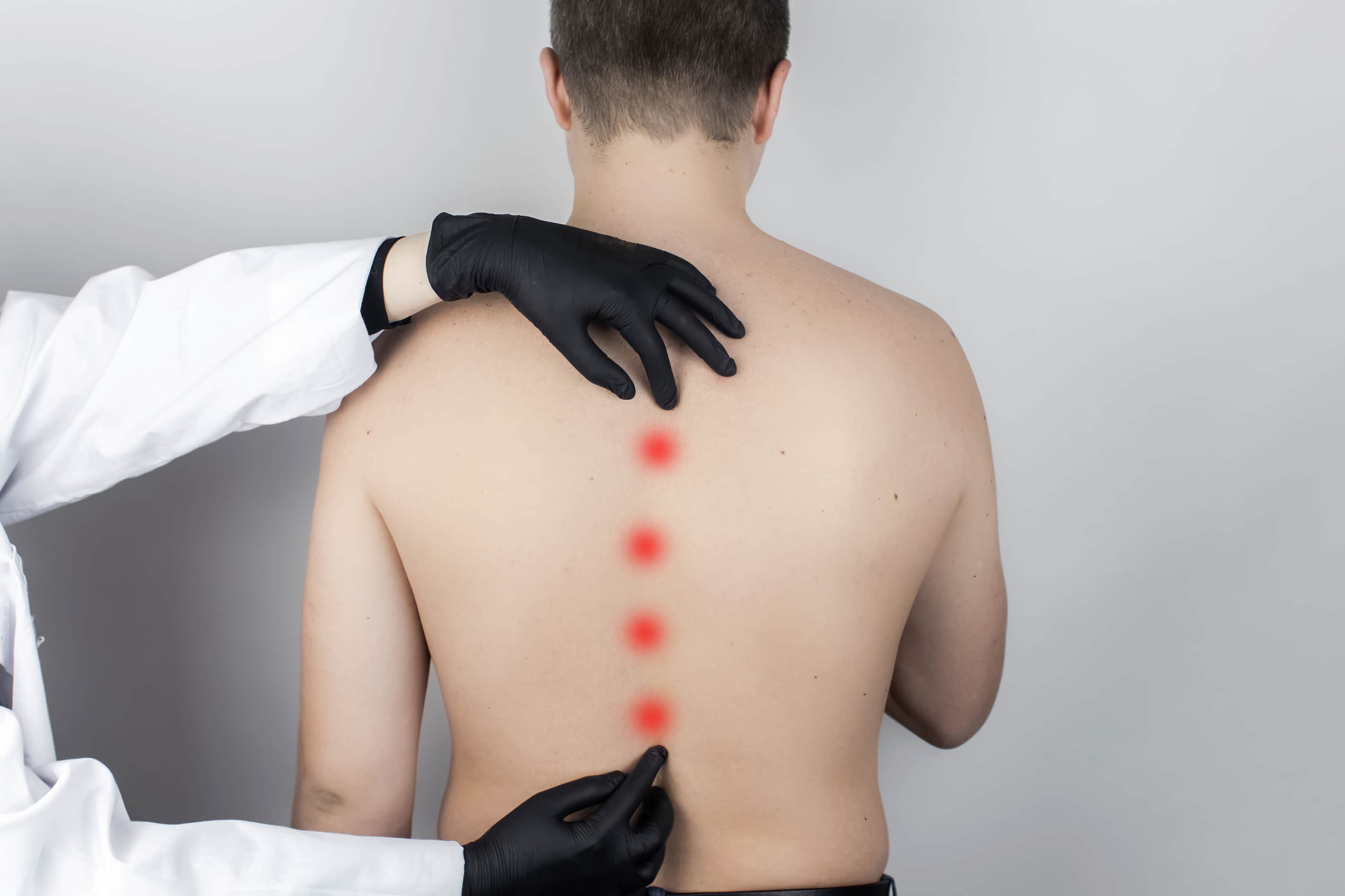 Scoliosis Surgery Success Rate in Turkey