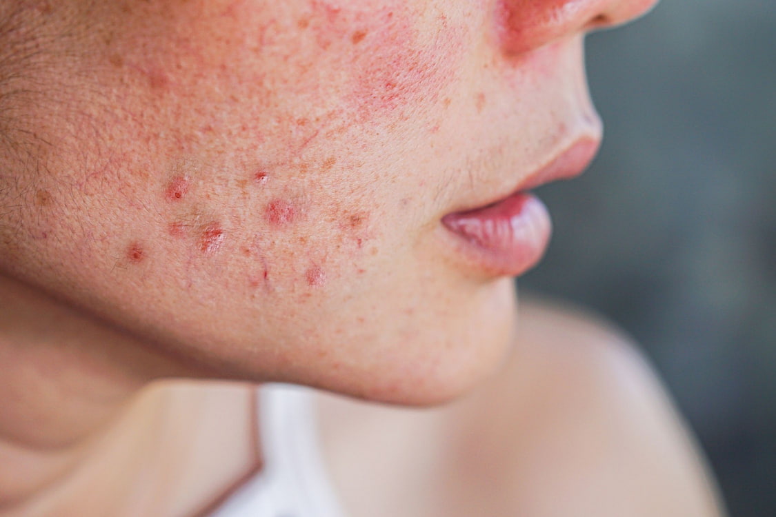what causes red spots on skin