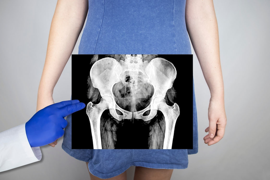 pelvic scans and gynecological conditions early detection and treatment